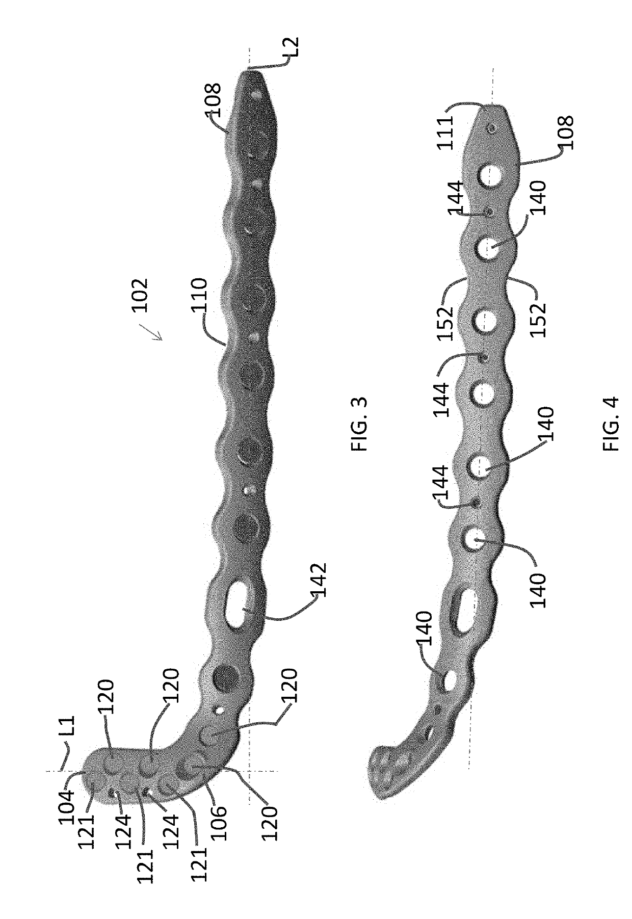 Distal tibial plating system