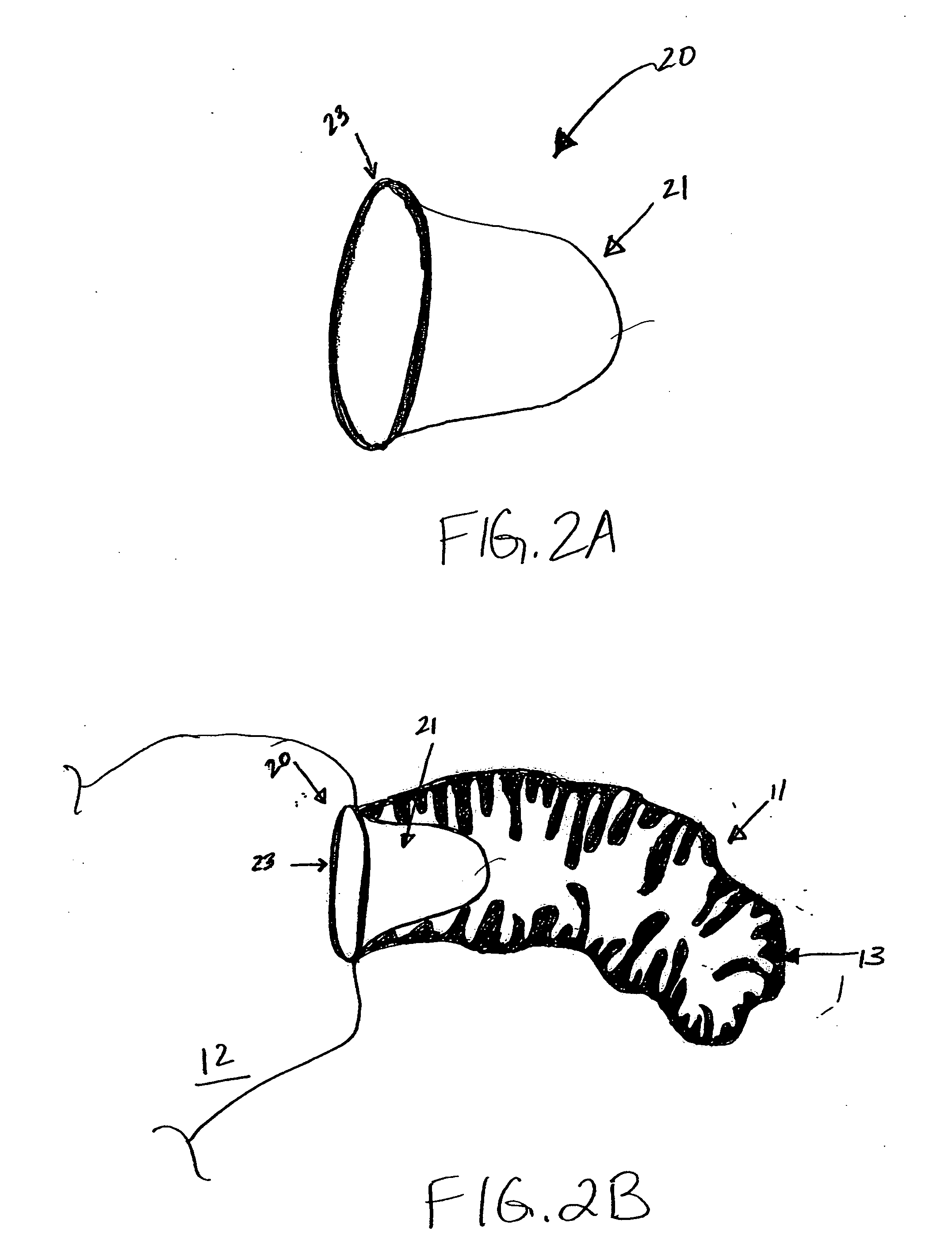 Device and methods for preventing formation of thrombi in the left atrial appendage