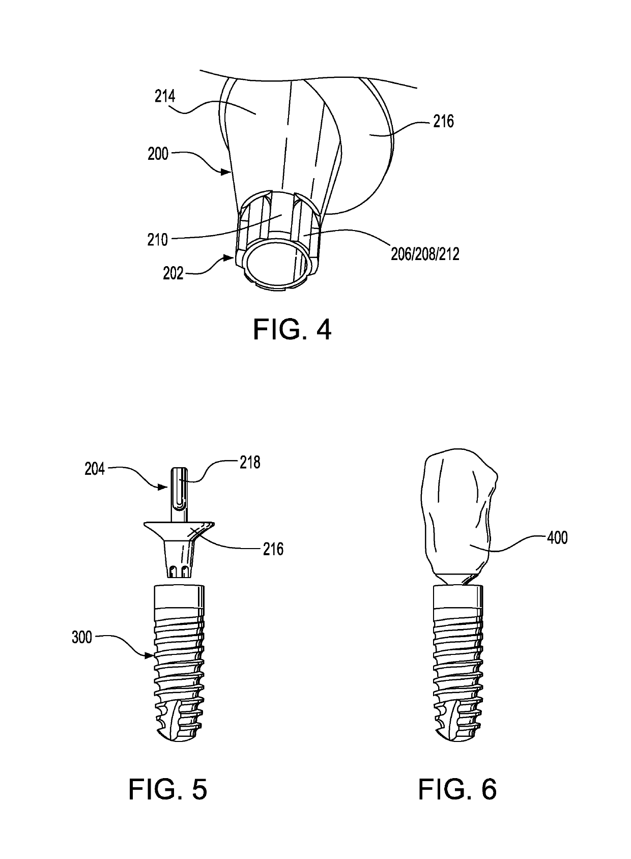 Dental treatment method and abutment used therein