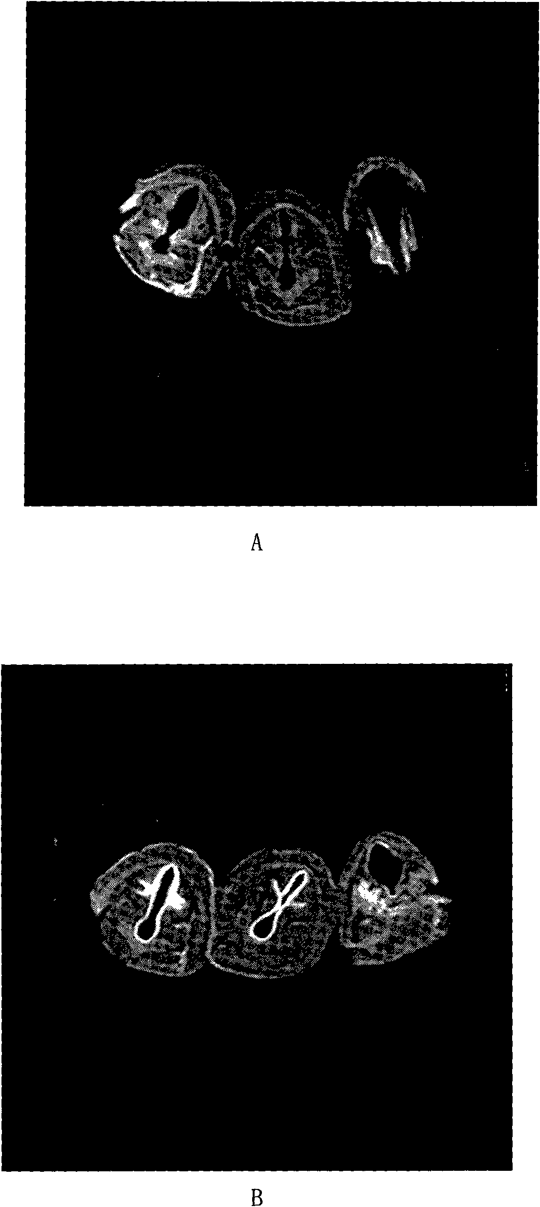 Respiratory-tract magnetic-resonance spray contrast agent and preparation method thereof