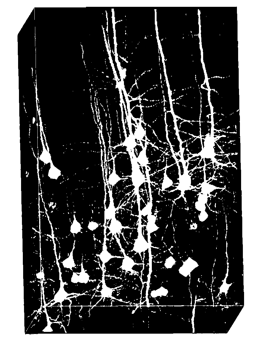 Automatic cell localization method based on minimized model L1