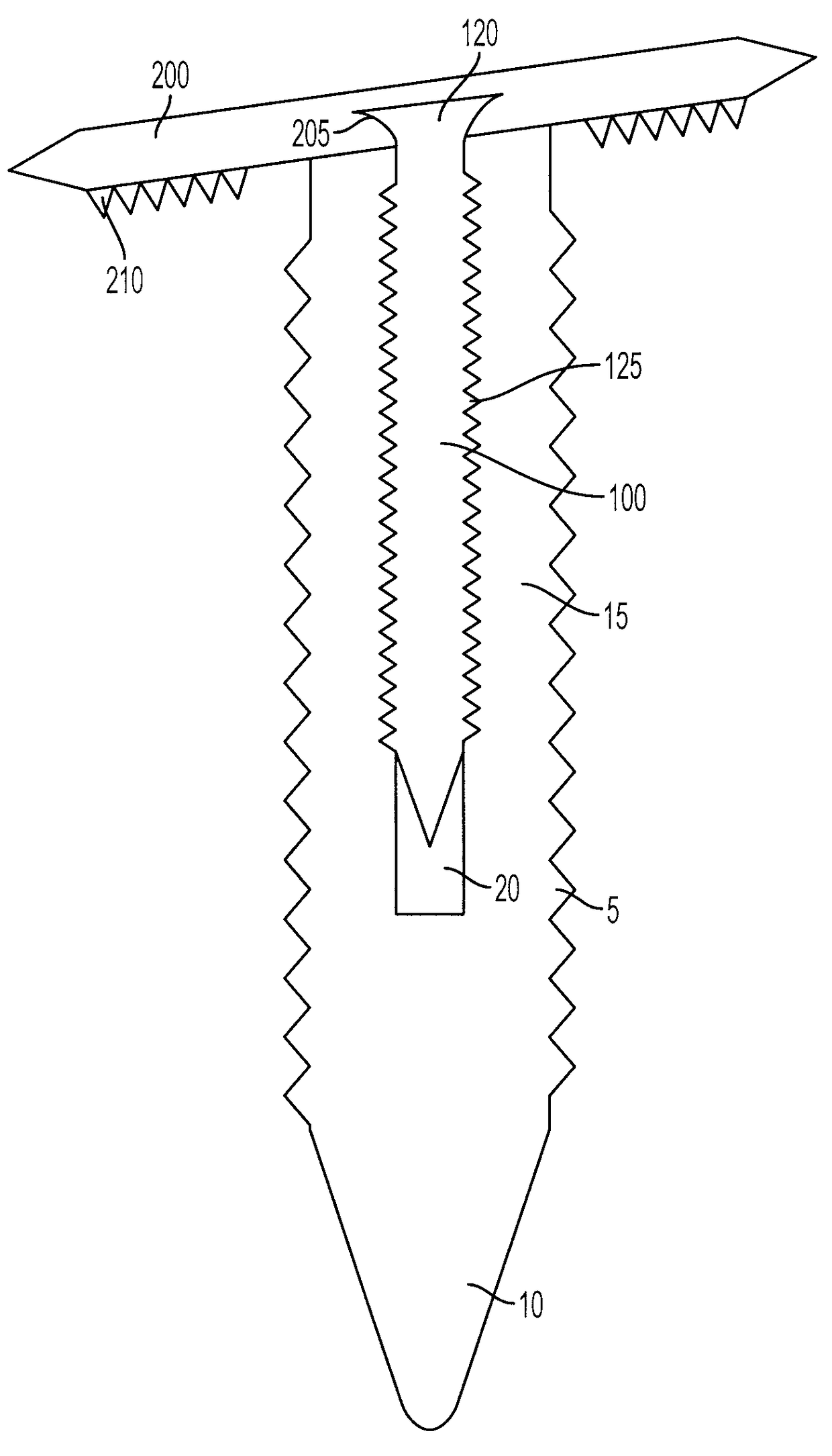 Surgical screw and method of performing ligament reconstruction using said screw