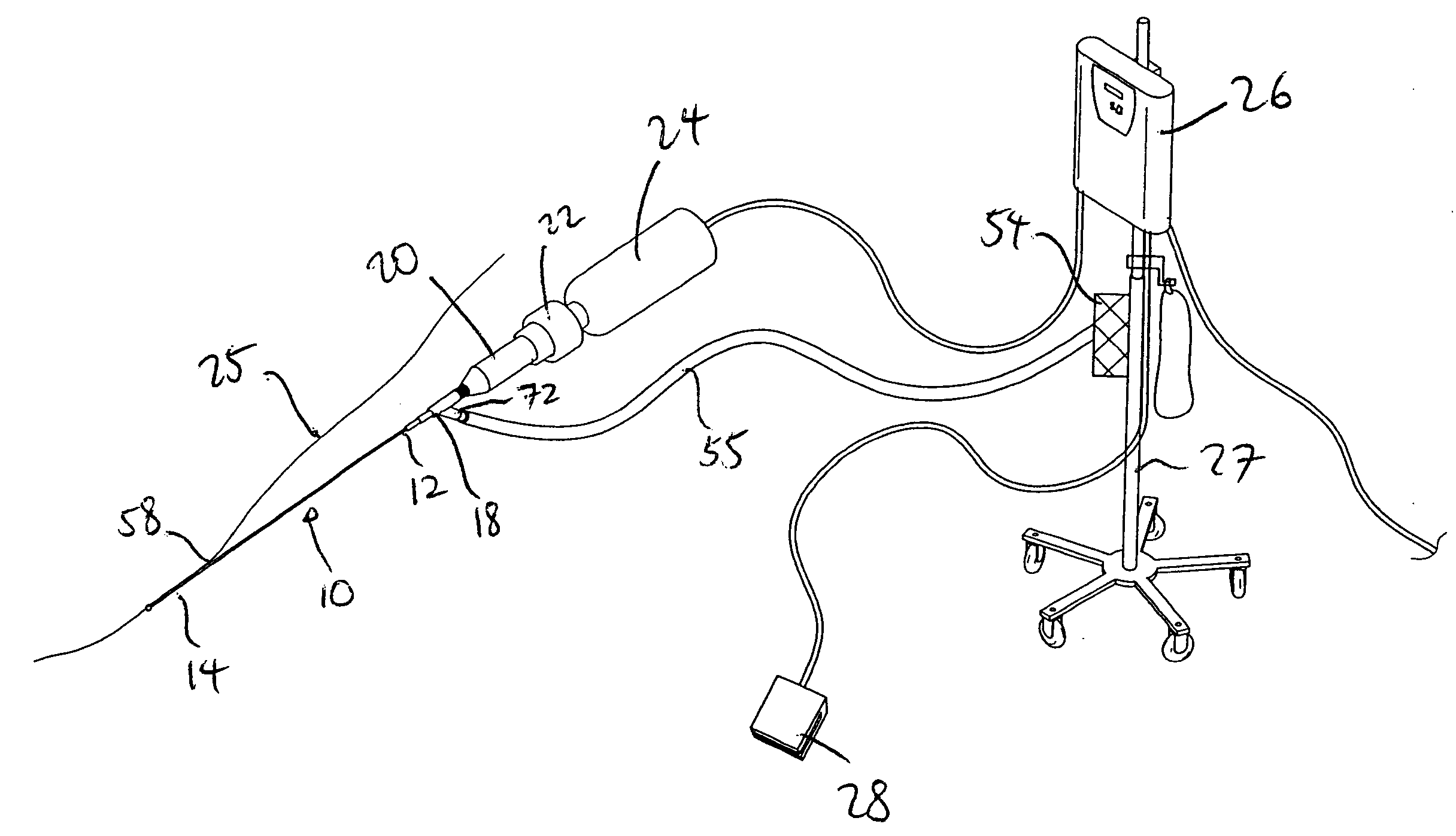 Ultrasound catheter having protective feature against breakage