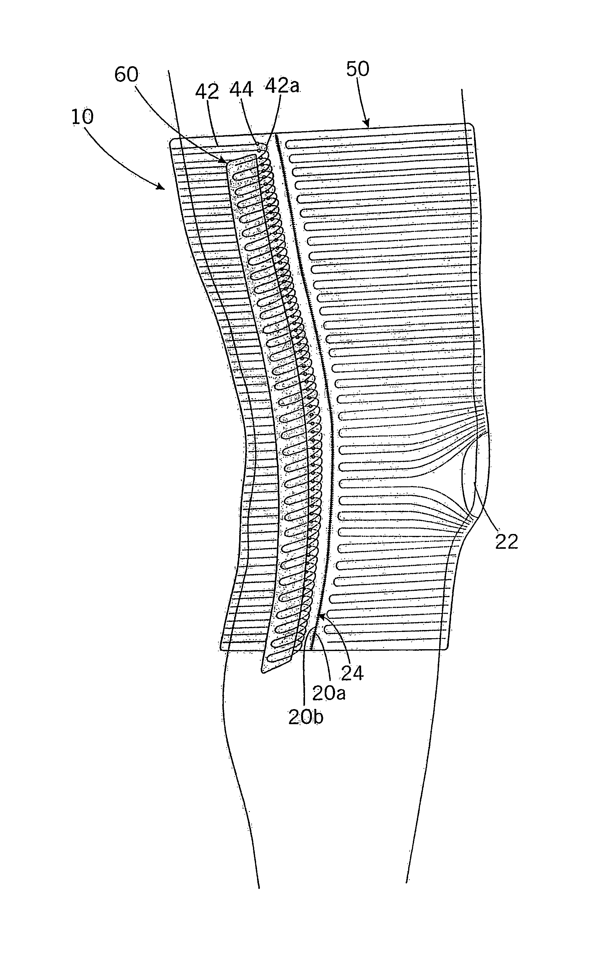 Compression bandage and method for its manufacture