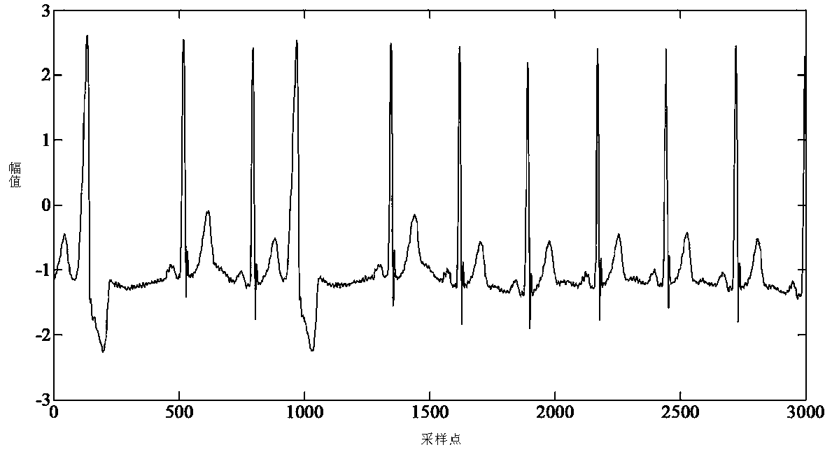 A method for automatic noise reduction of ECG signals