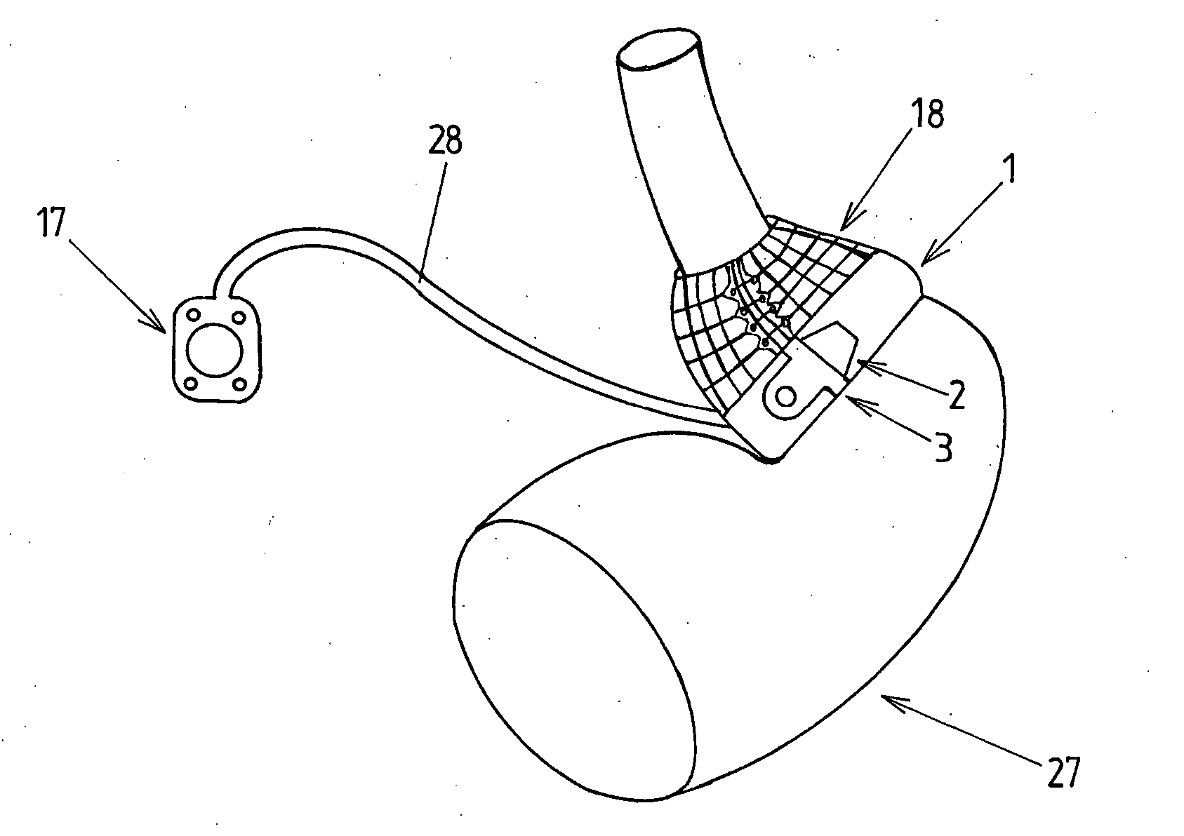 Device for treating obesity