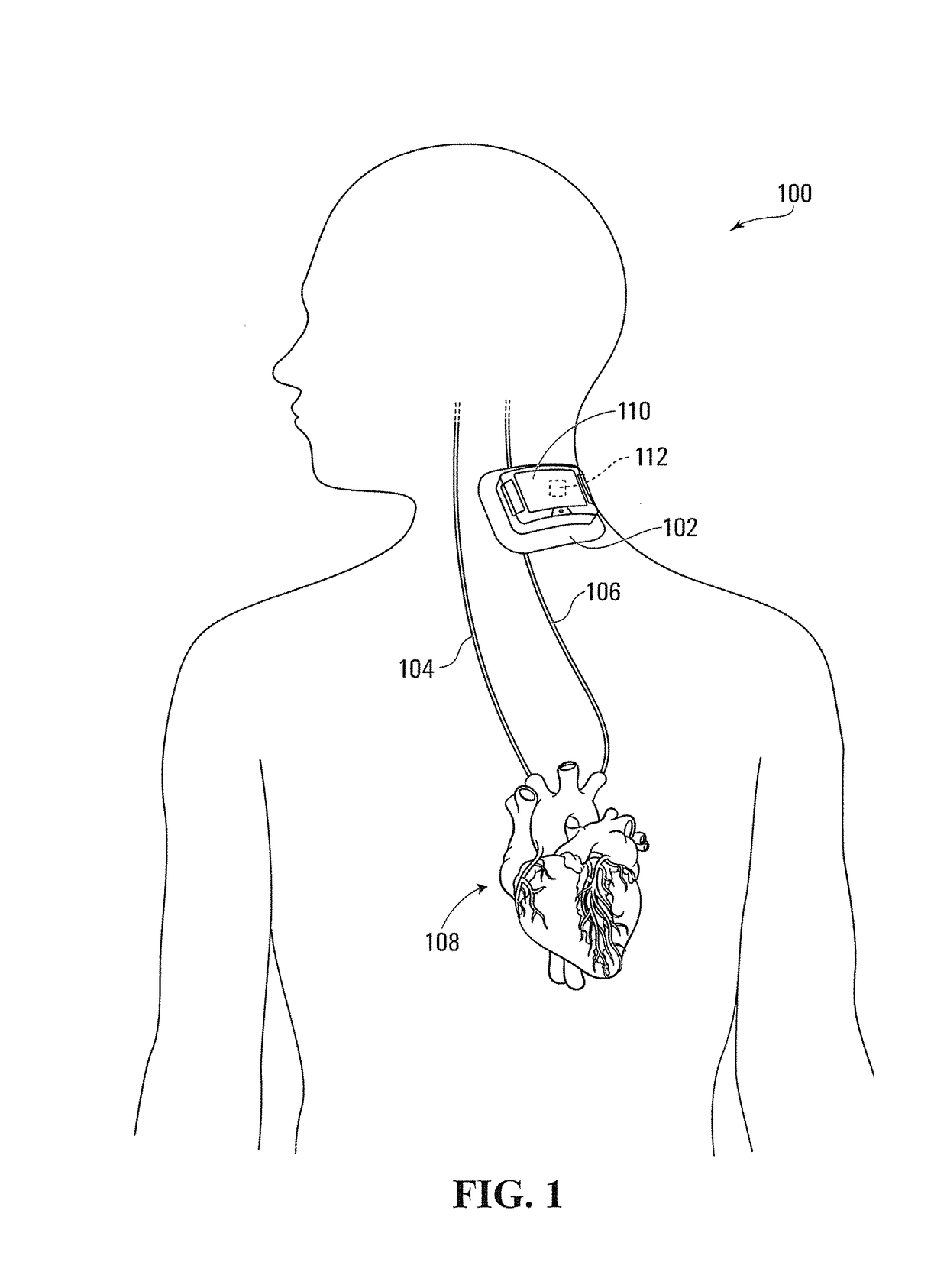 Systems and methods for automated fluid response measurement