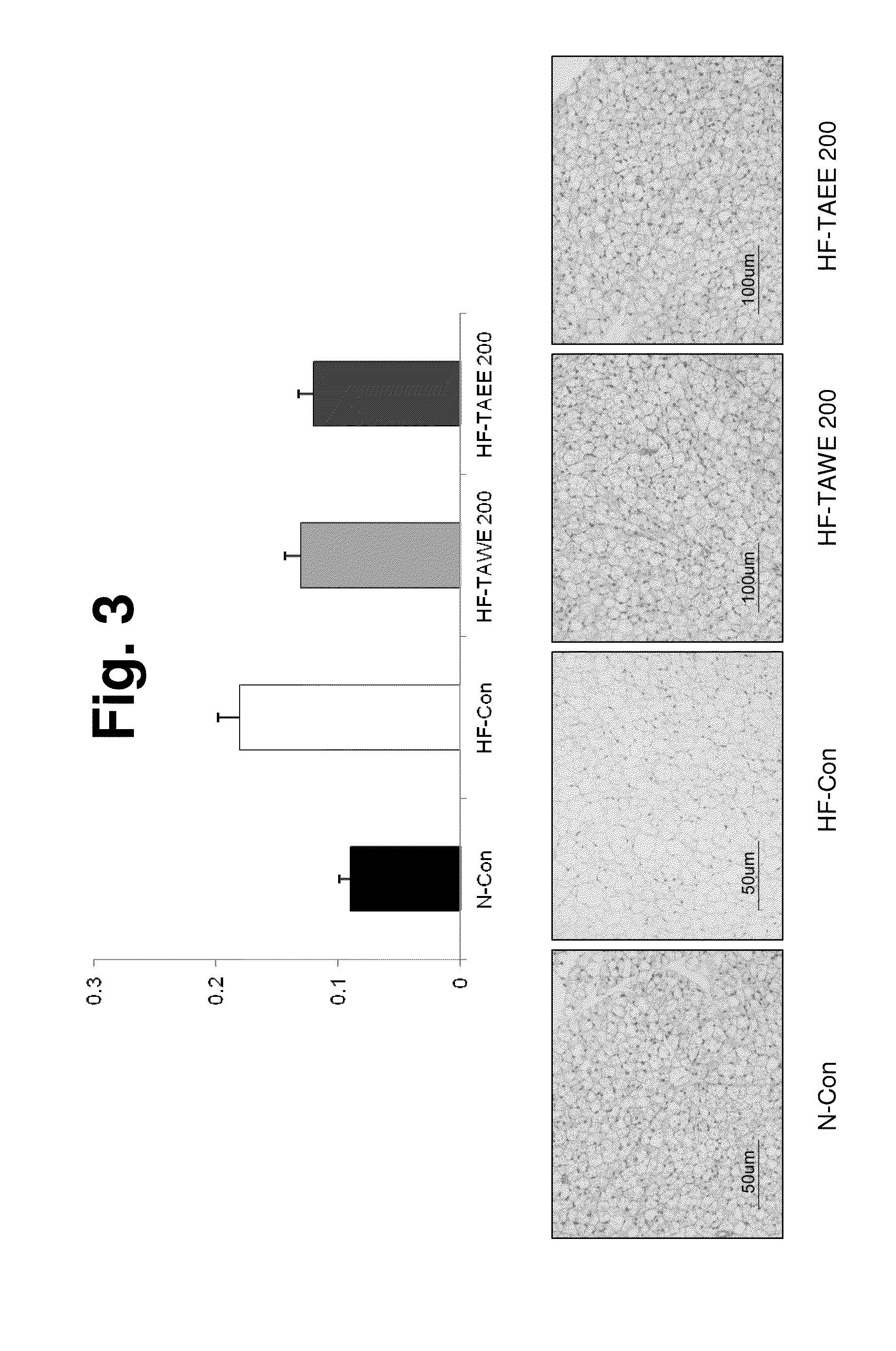 Composition for treating and preventing obesity, containing wheatgrass extract as active ingredient