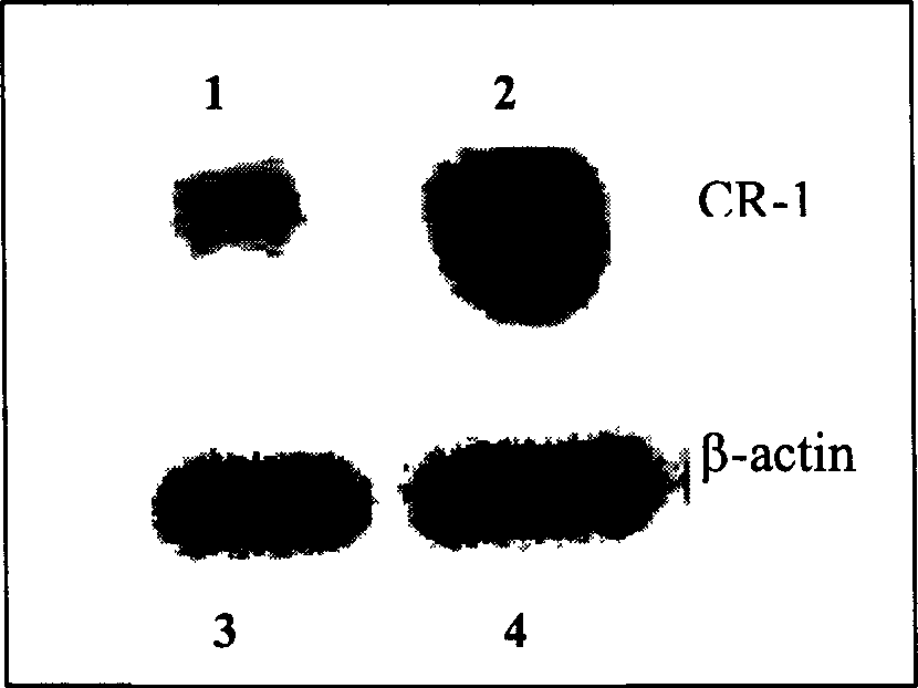 CR1 gene related to cell reconstitution, conduction and death