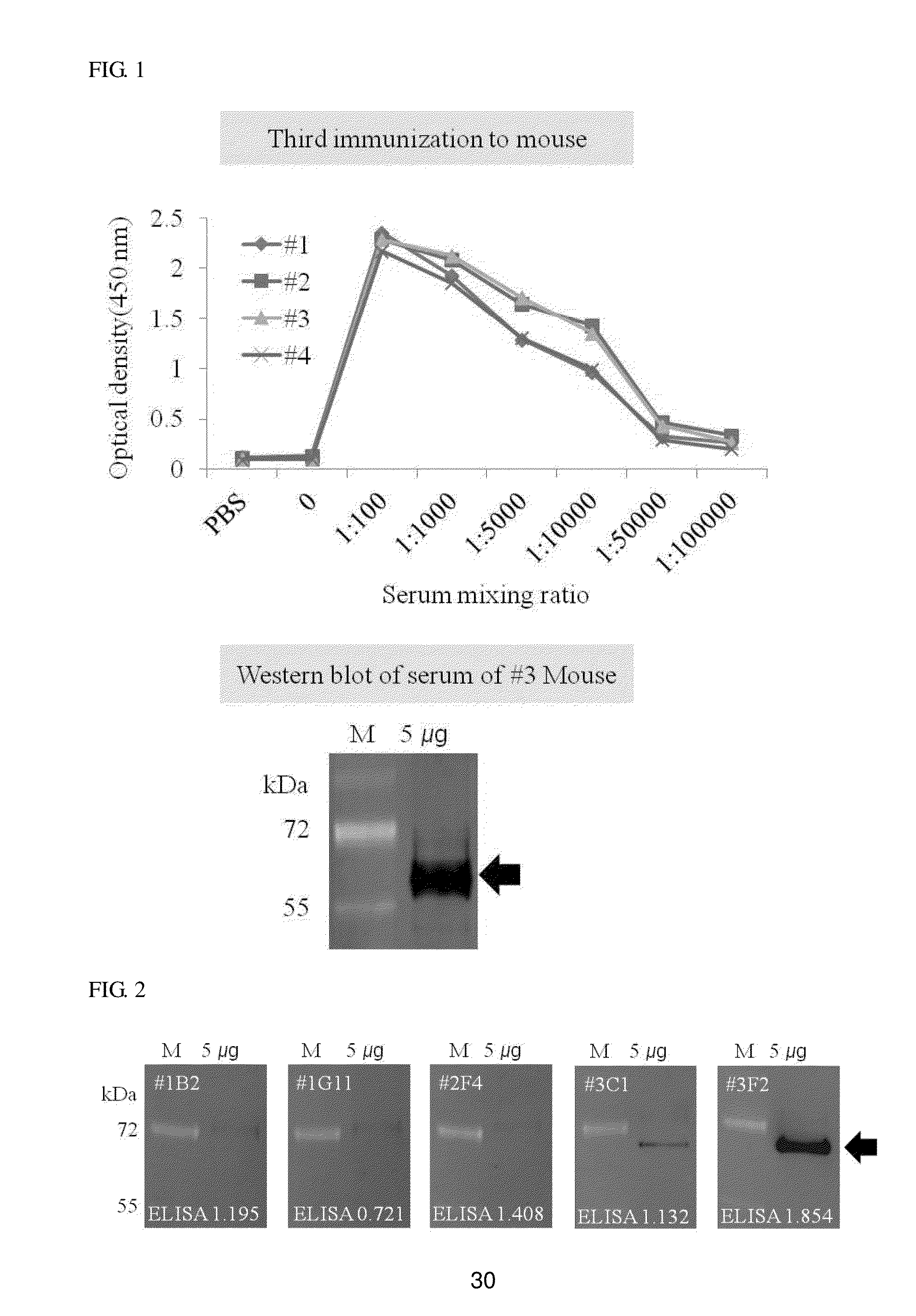 Monoclonal Antibodies which Specifically Recognize Human Liver-Carboxylesterase 1, Hybridoma Cell Lines which Produce Monoclonal Antibodies, and Uses Thereof