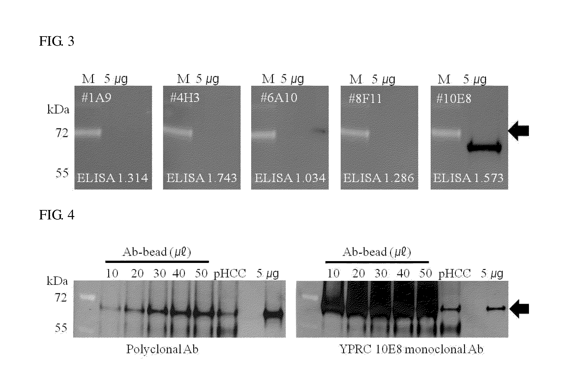 Monoclonal Antibodies which Specifically Recognize Human Liver-Carboxylesterase 1, Hybridoma Cell Lines which Produce Monoclonal Antibodies, and Uses Thereof