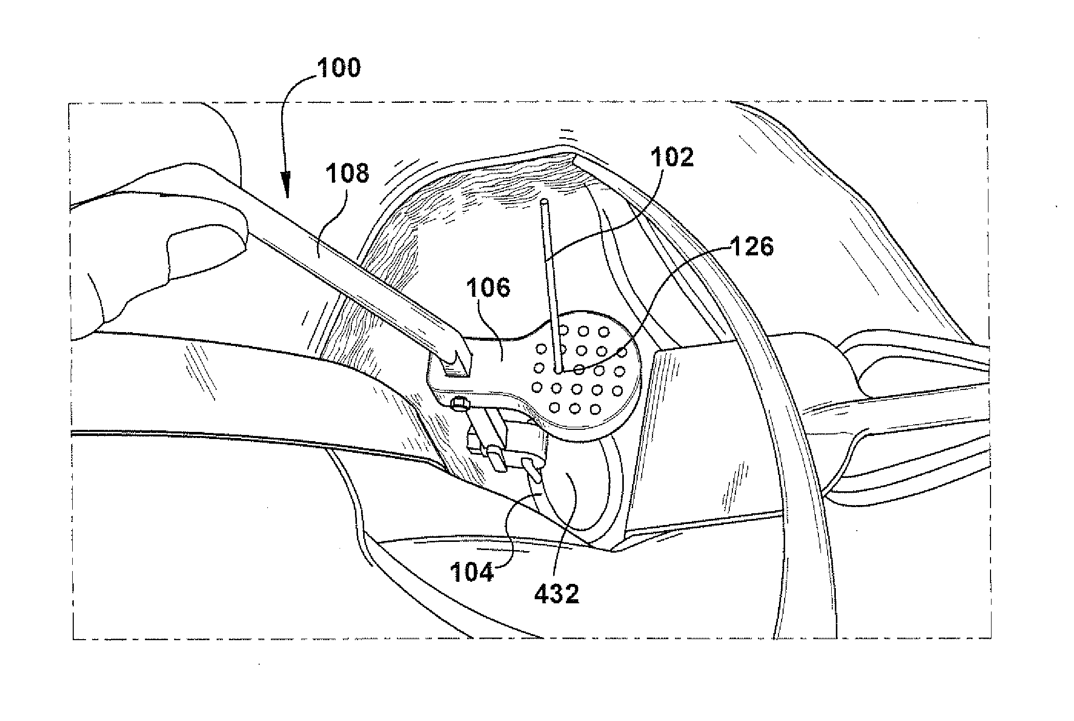 Method and apparatus for insertion of an elongate pin into a surface