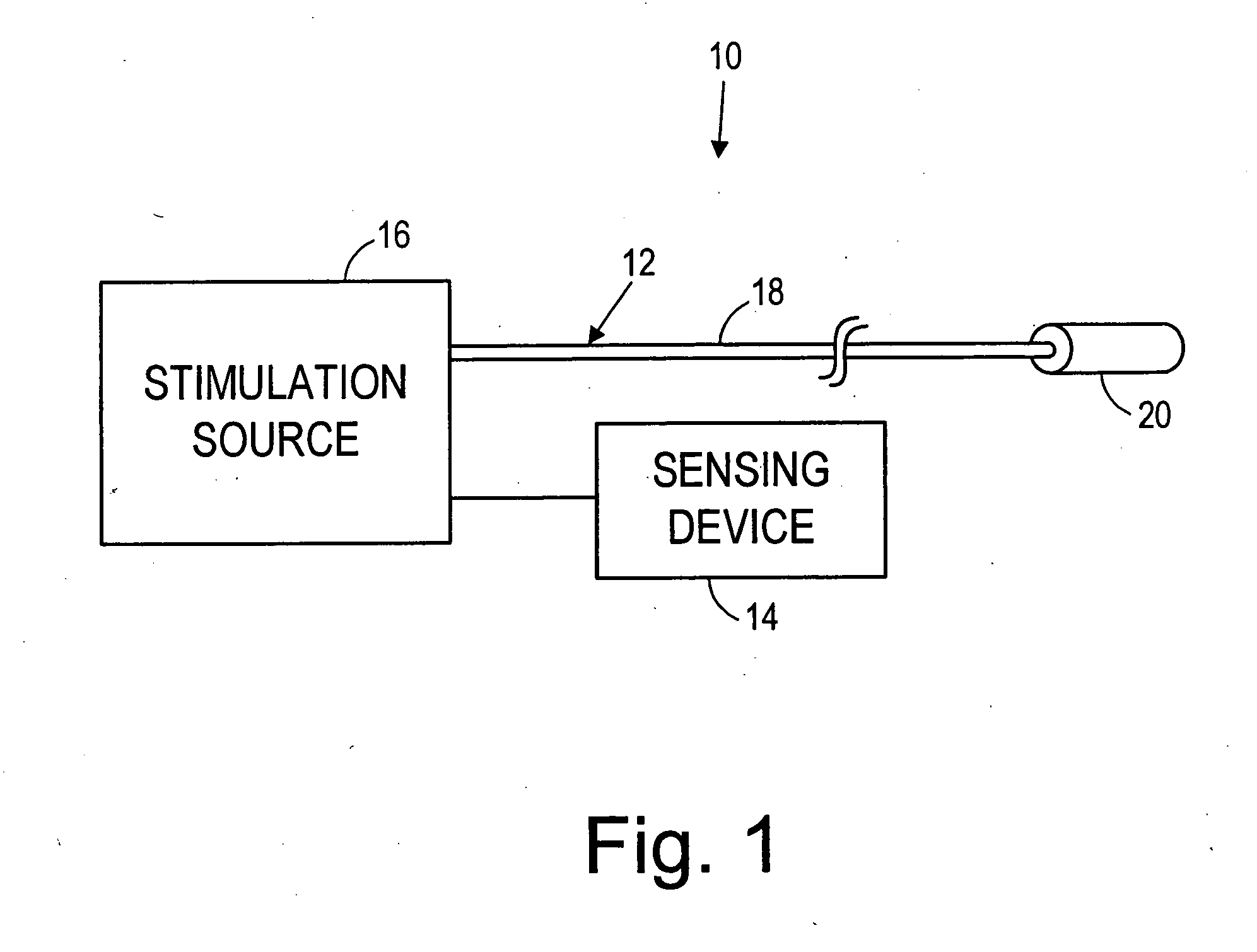 Method for stimulating neural tissue in response to a sensed physiological event
