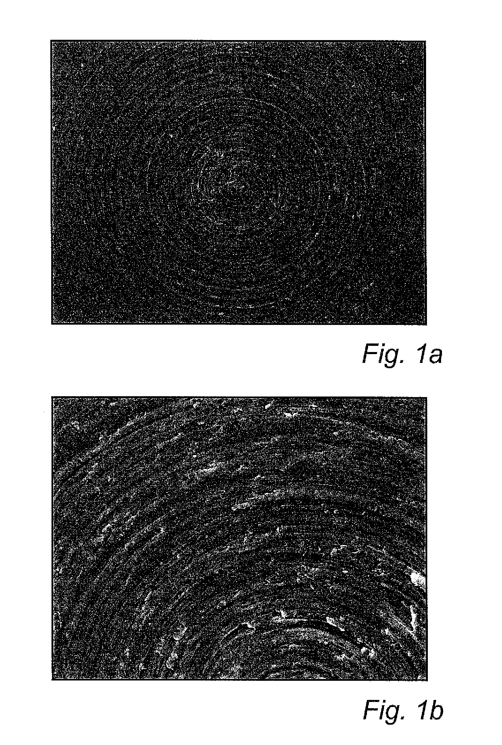 Medical device having a surface comprising nanoparticles