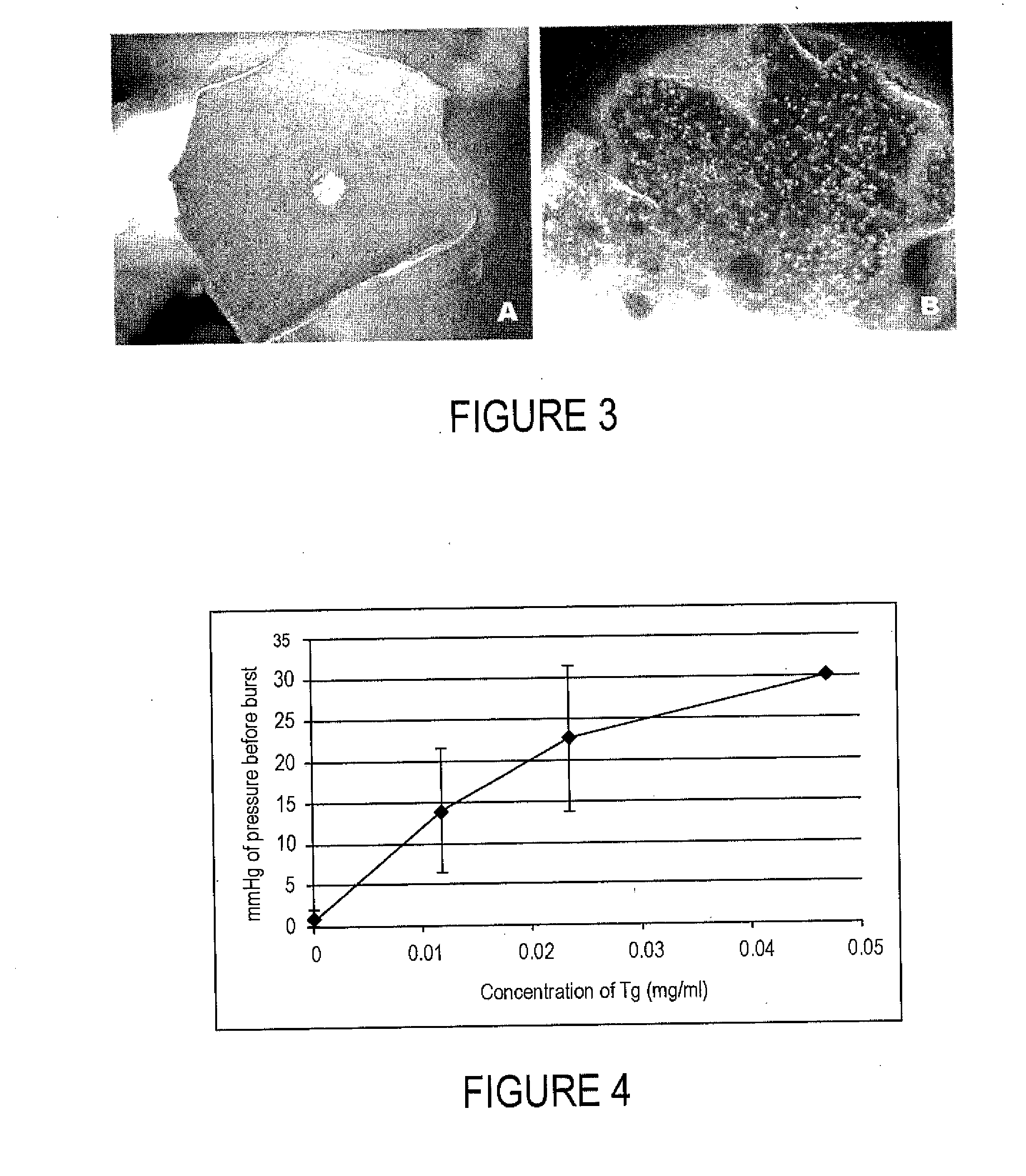 Gel delivery system for tissue repair