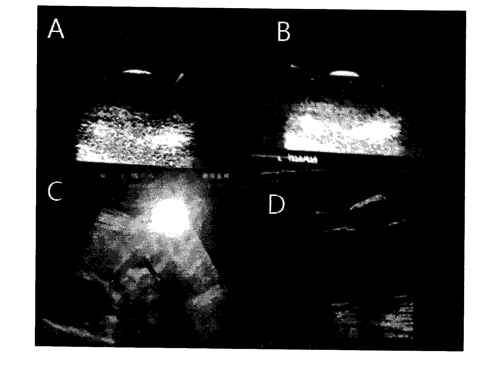 Production method and application of abdominal organ teaching simulation model applicable to type-B ultrasonic detection