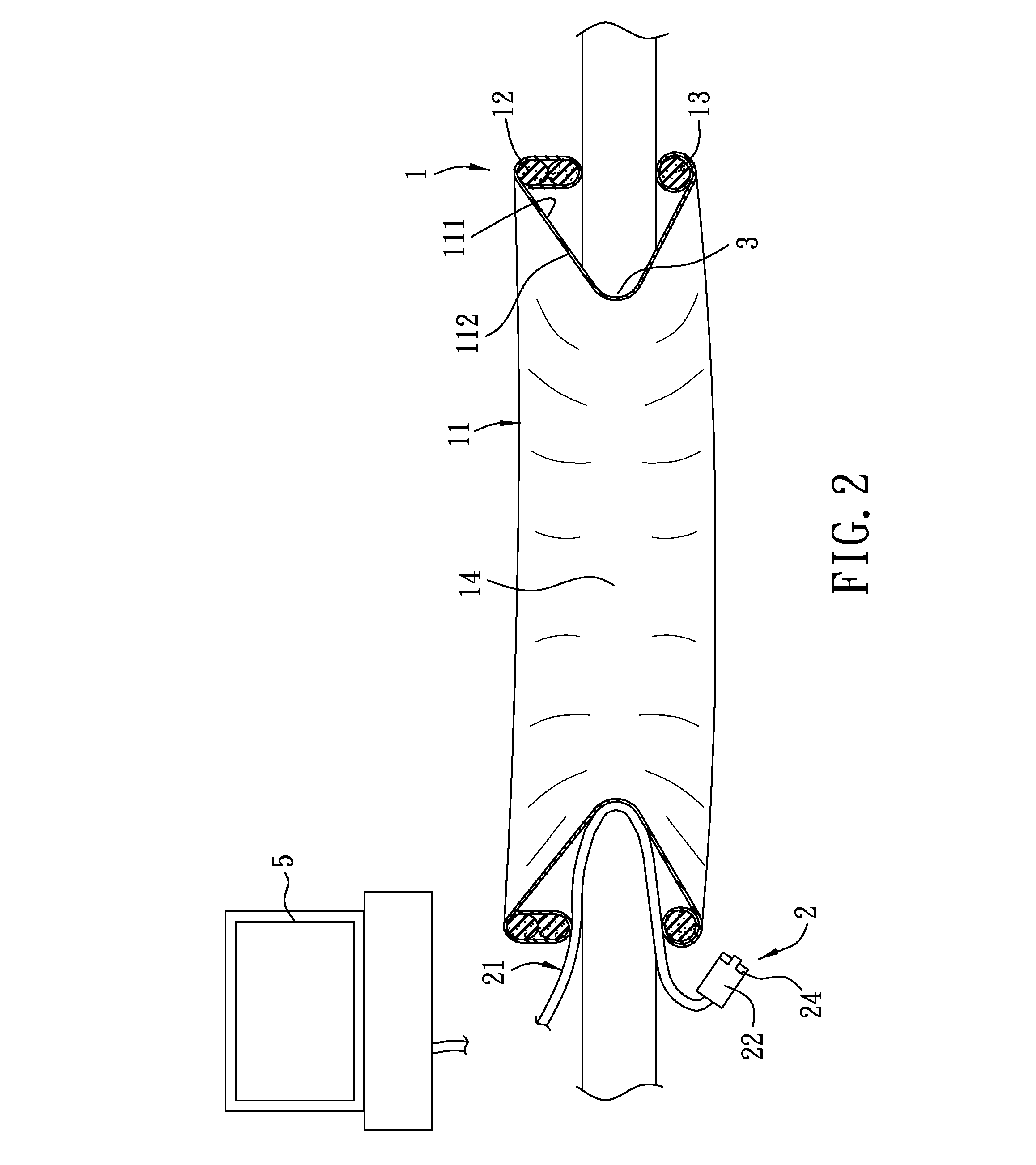 Combined retractor and endoscope system