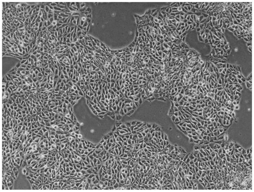 A method for inducing directional differentiation of pluripotent stem cells into cardiomyocytes