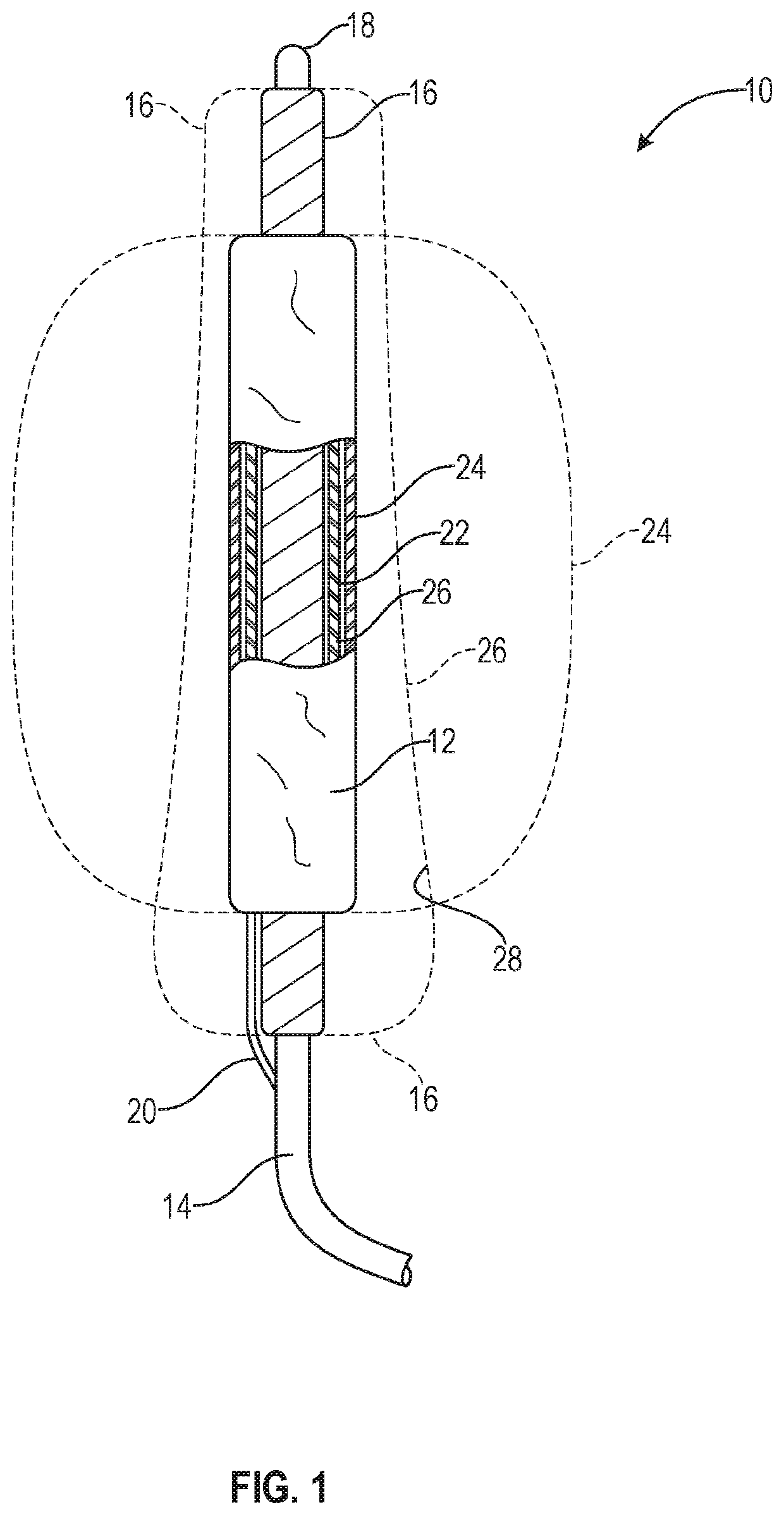 Modulation of inflammatory response following endovascular treatment