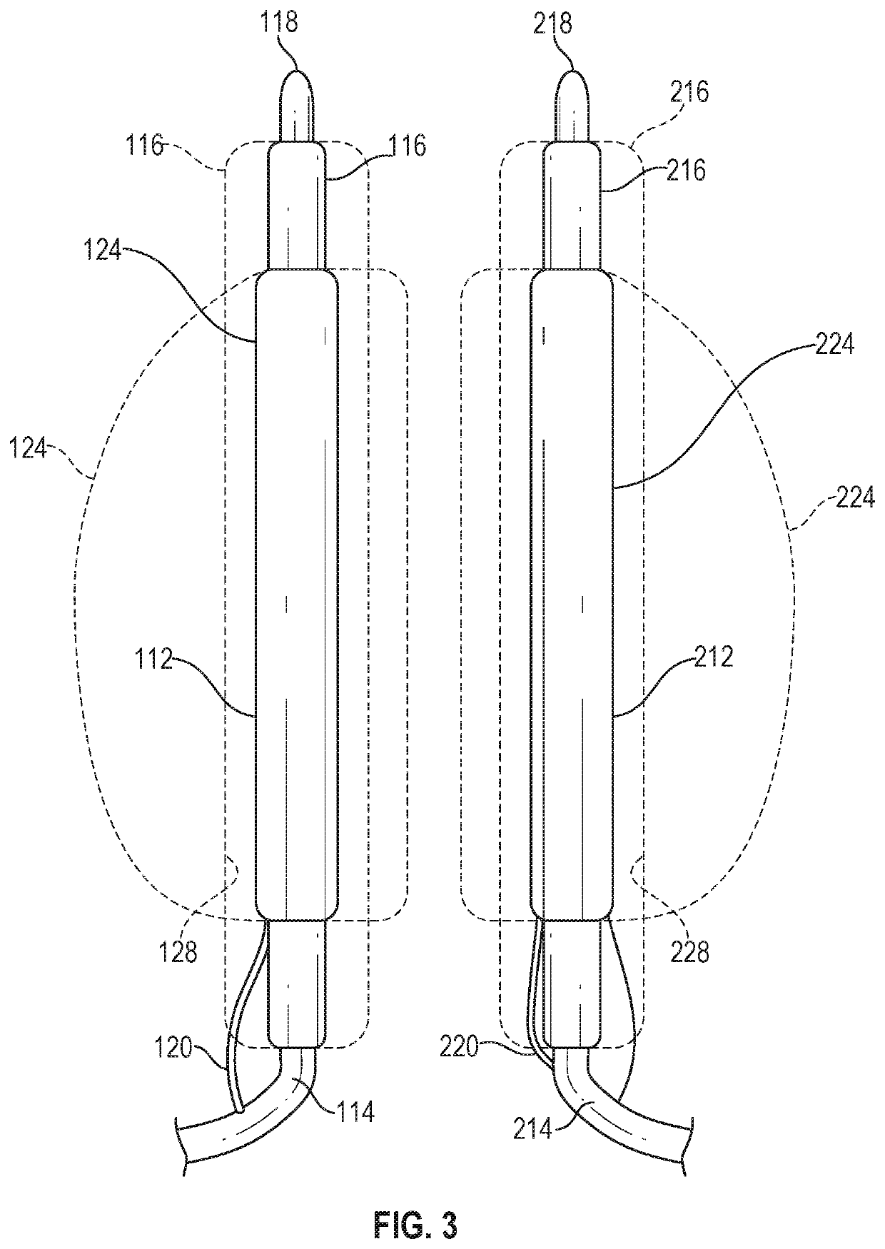 Modulation of inflammatory response following endovascular treatment