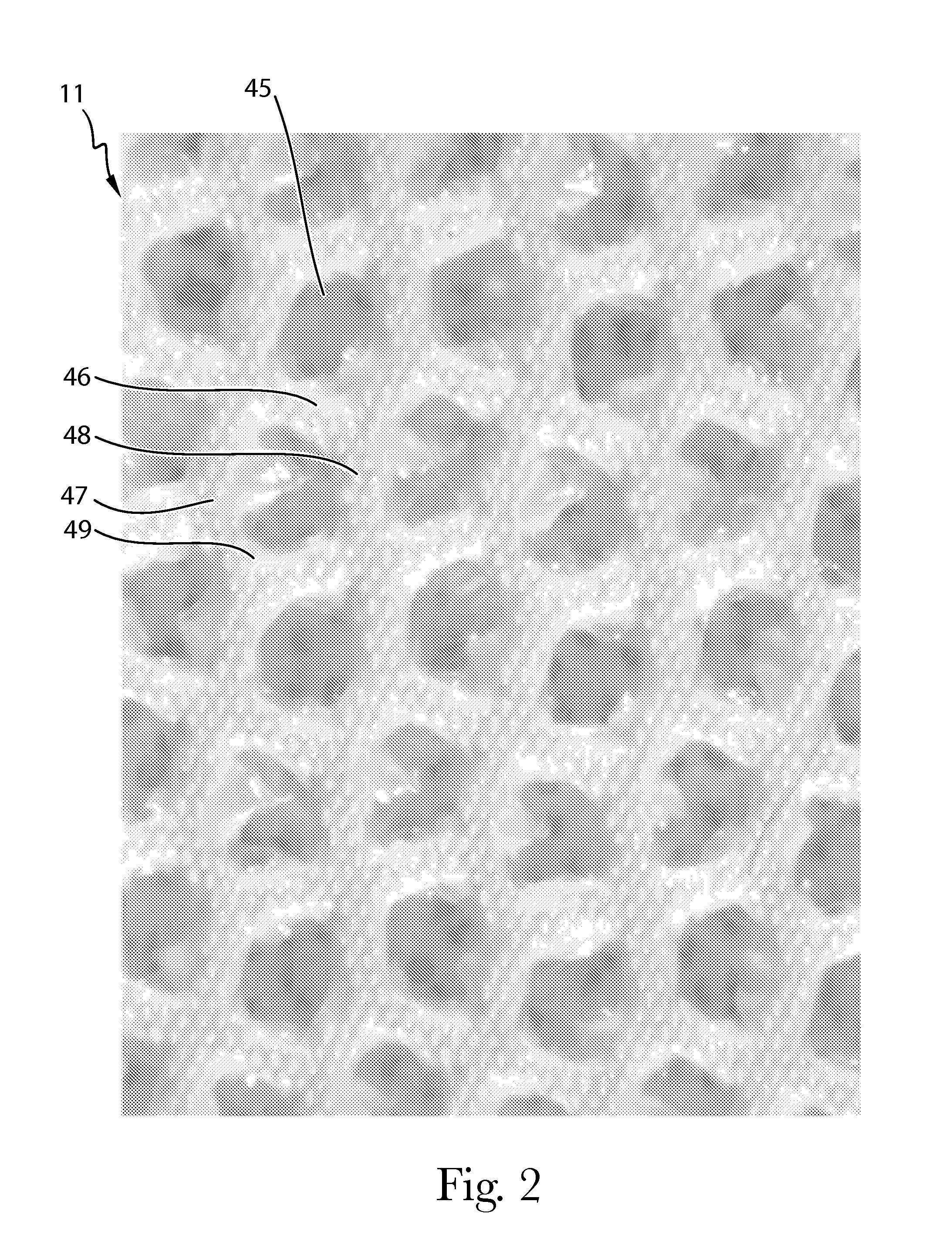 Absorbent Article Having Surface Visual Texture