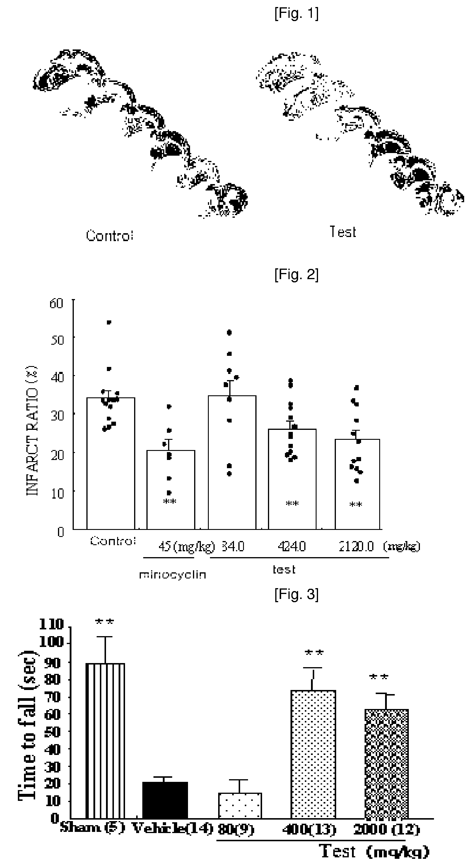Composition comprising the extract of crude drug complex having neuroprotective activity for preventing and treating stroke and neurodegenerative diseases