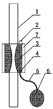 Ventricle-abdominal cavity cerebrospinal fluid diversion device