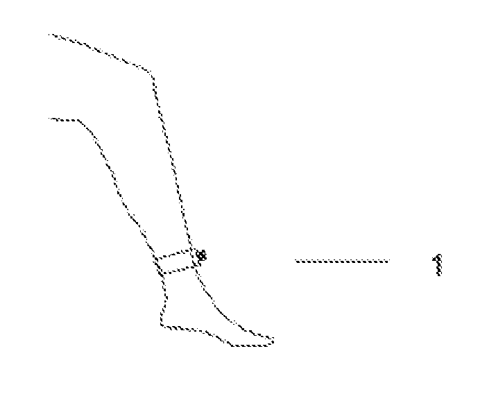 Electronic apparatus for measuring the patellar reflex and other reflexes