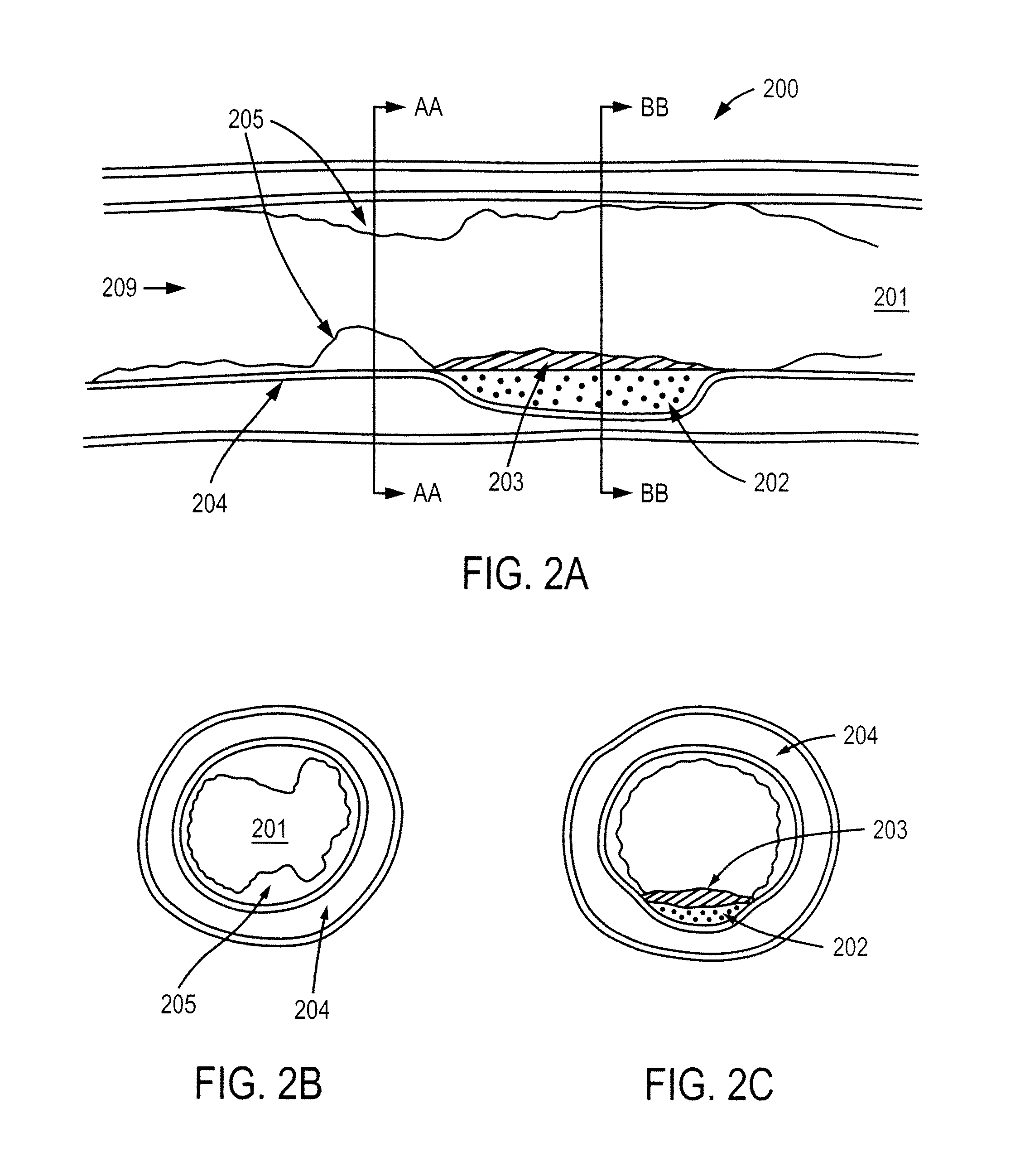 Methods and apparatuses for coating a lesion