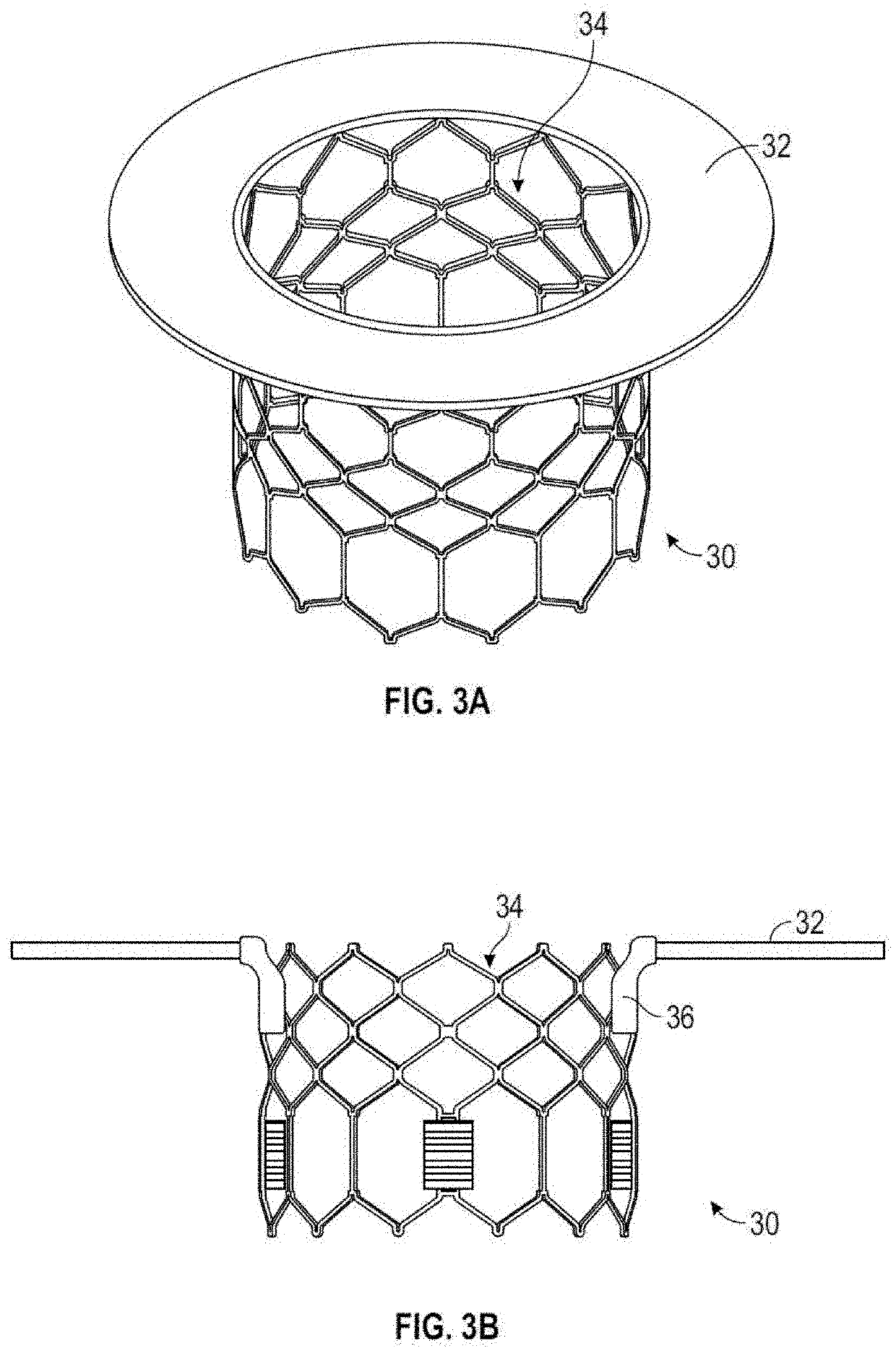 Systems, devices, and methods for treating heart valves