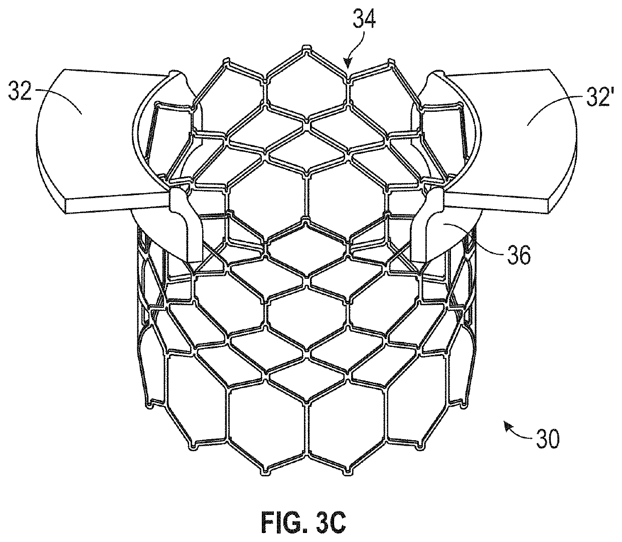 Systems, devices, and methods for treating heart valves