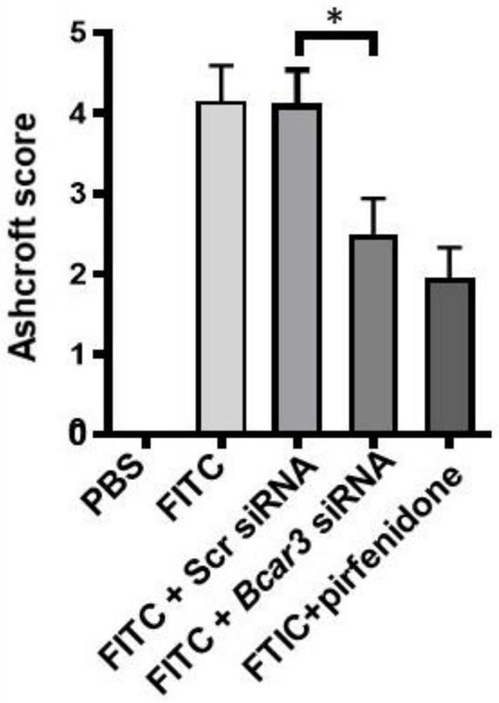 BCAR3 inhibitors and their use in prevention and treatment of fibrotic diseases