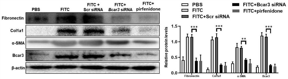 BCAR3 inhibitors and their use in prevention and treatment of fibrotic diseases