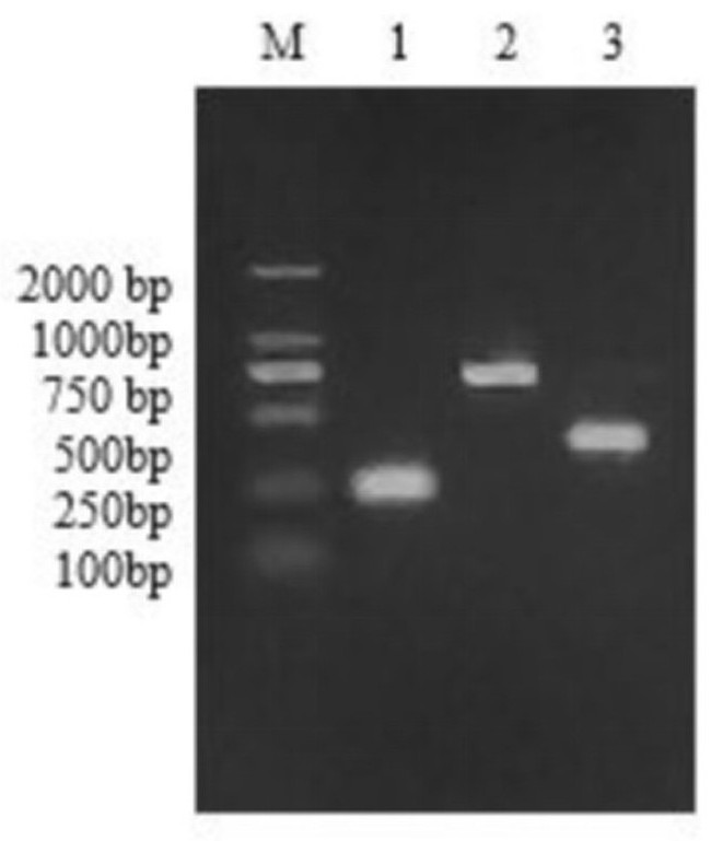 A kind of streptococcus parauberis derived from turbot and its application