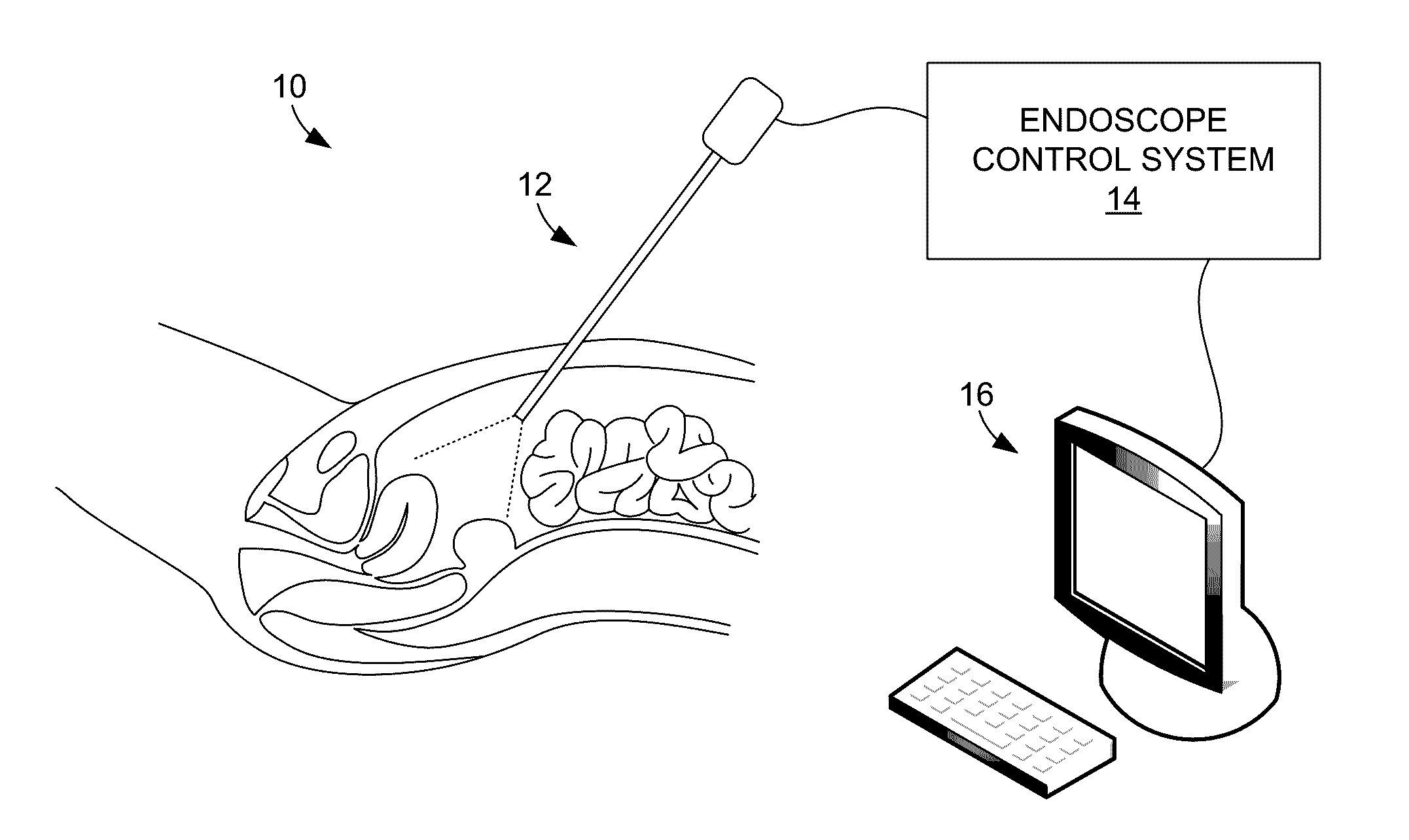 Systems and methods for providing augmented reality in minimally invasive surgery