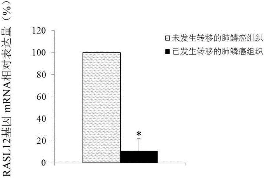 RASL12 gene serving as diagnosis and treatment target of lung squamous cell carcinoma metastasis