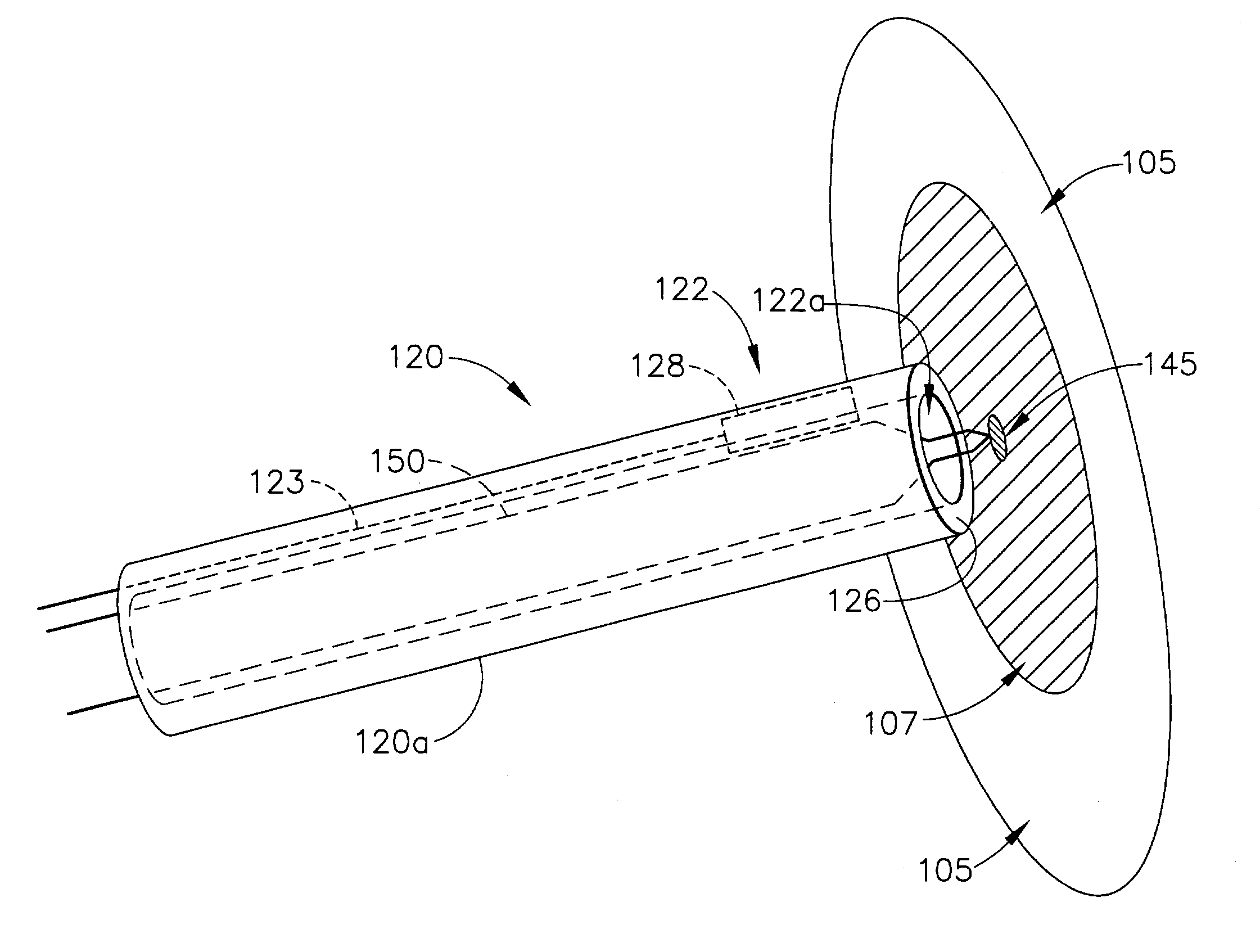 Method and device for transseptal facilitation based on injury patterns