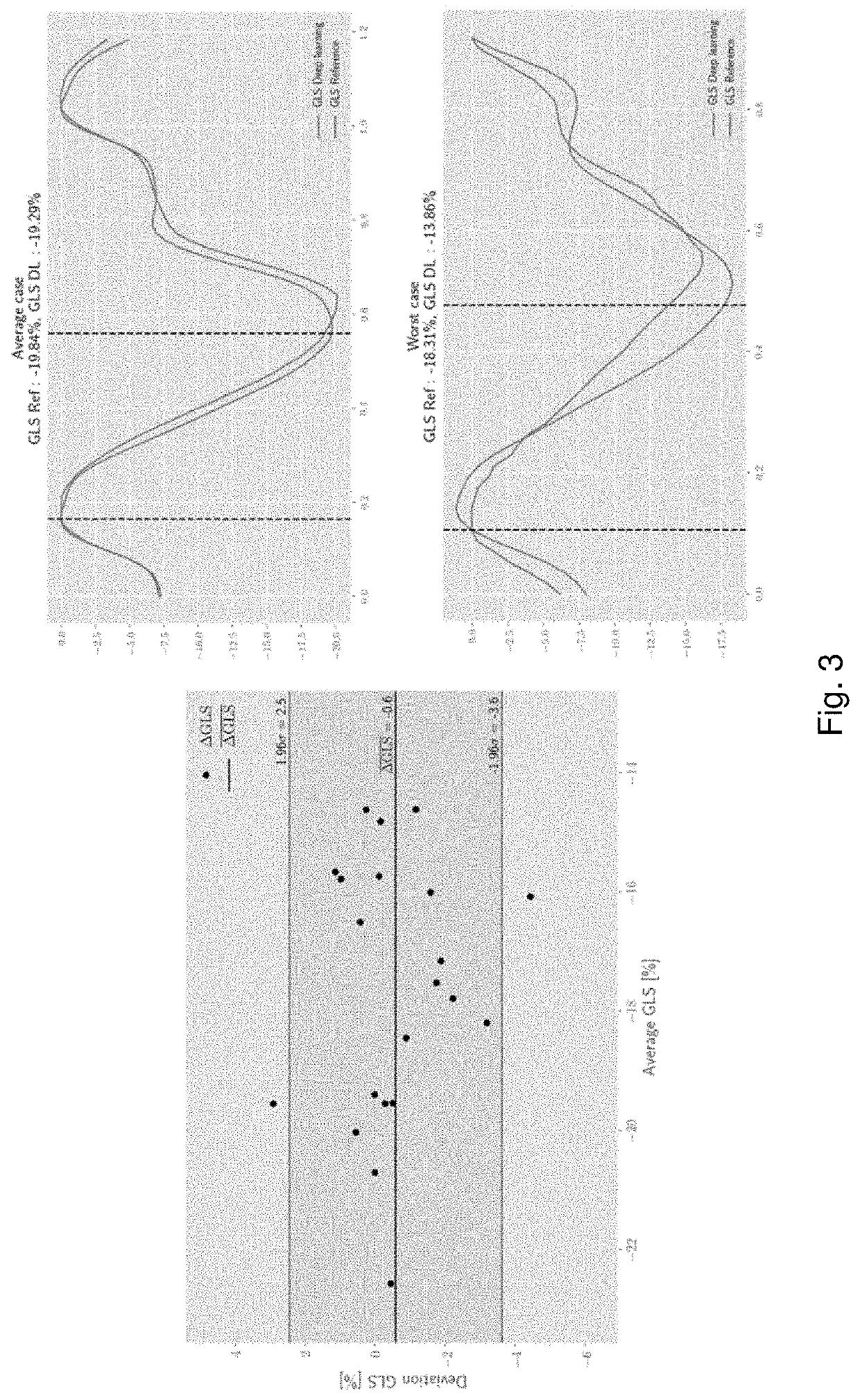 Functional measurements in echocardiography