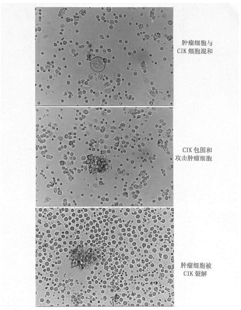 Induced amplification method of CIK2 (NK NK-T) cells