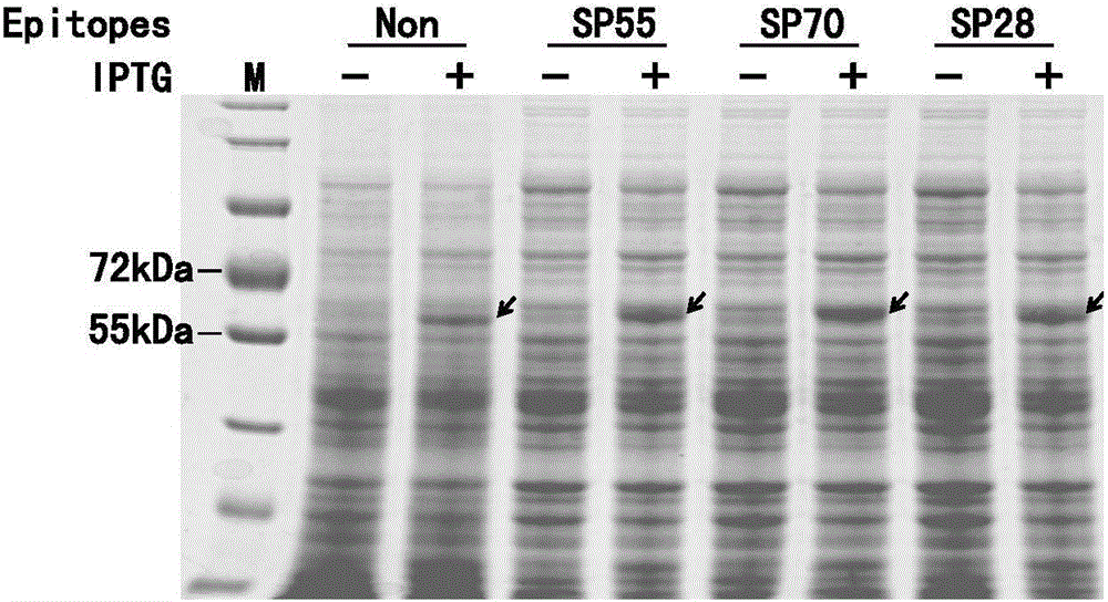 Establishing and expressing method for chimeric vector of EV71 neutralization epitope and norovirus P structure domain