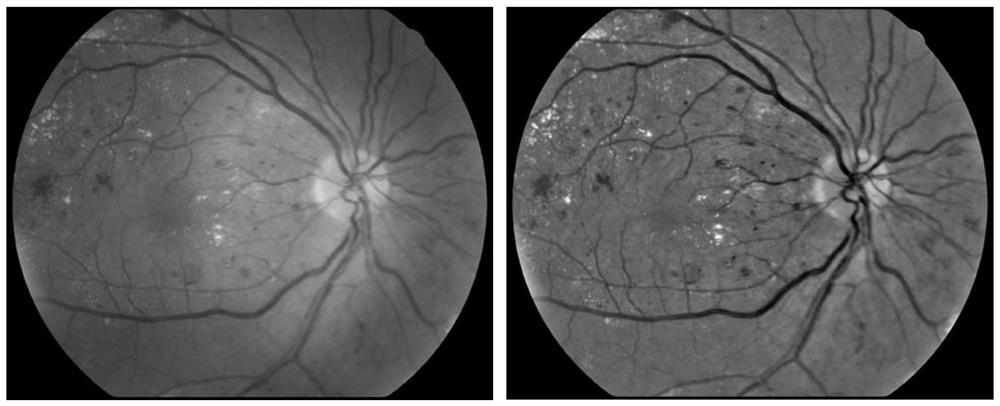 A method for quality control of fundus images