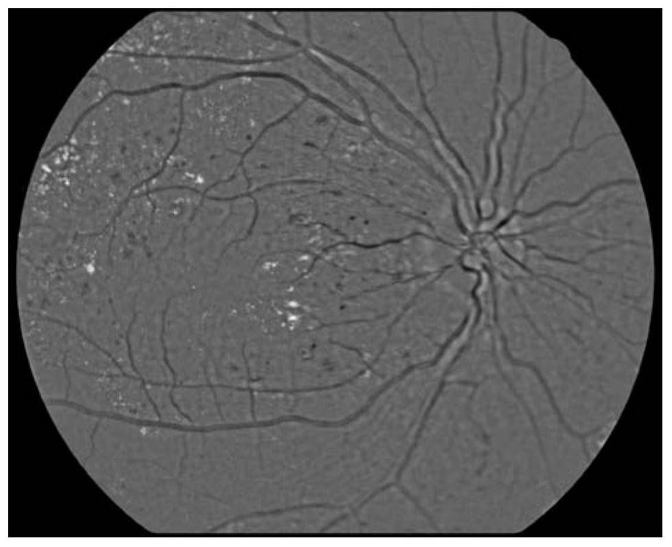 A method for quality control of fundus images