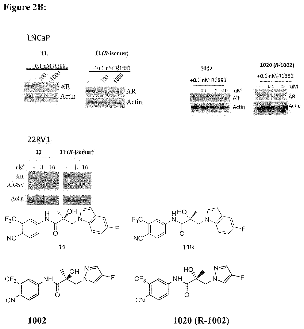 Selective androgen receptor degrader (SARD) ligands and methods of use
