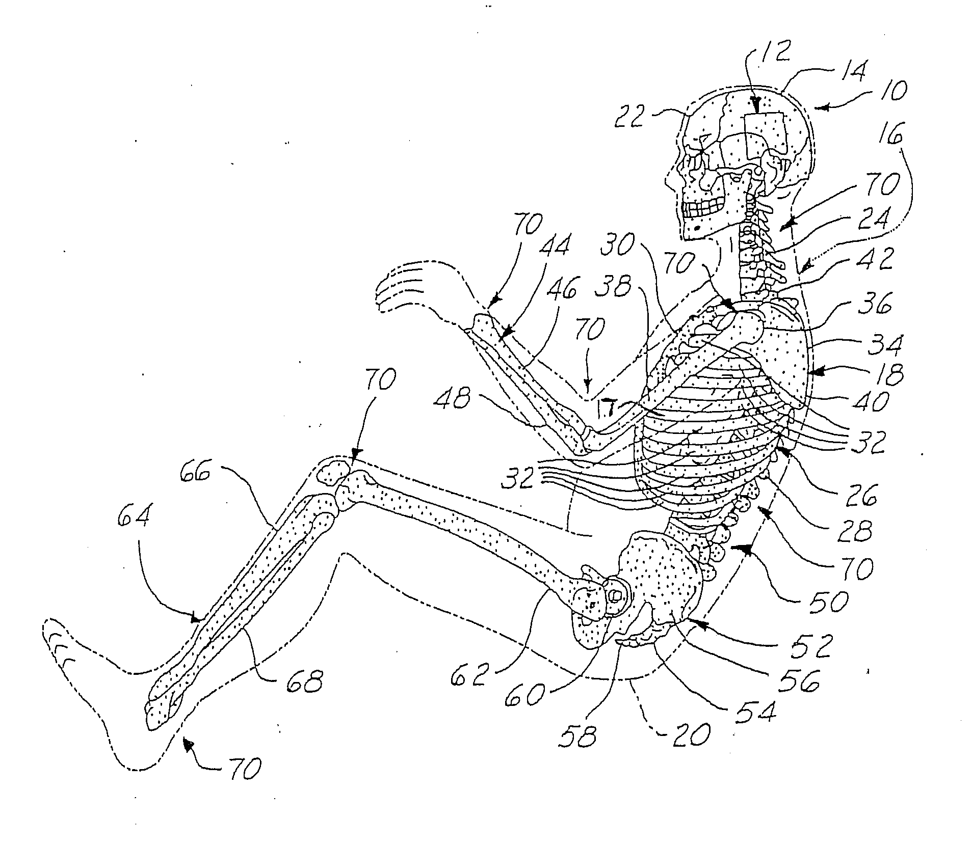 Vehicular dynamic ride simulation system using a human biofidelic manikin and a seat pressure distribution sensor array