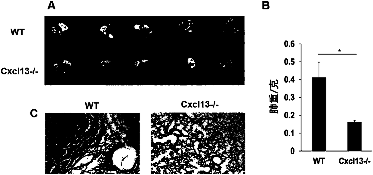 Use of active substances for reducing activity or expression quantity of CXCL13 protein in preparing medicines for treating malignant tumor metastasis