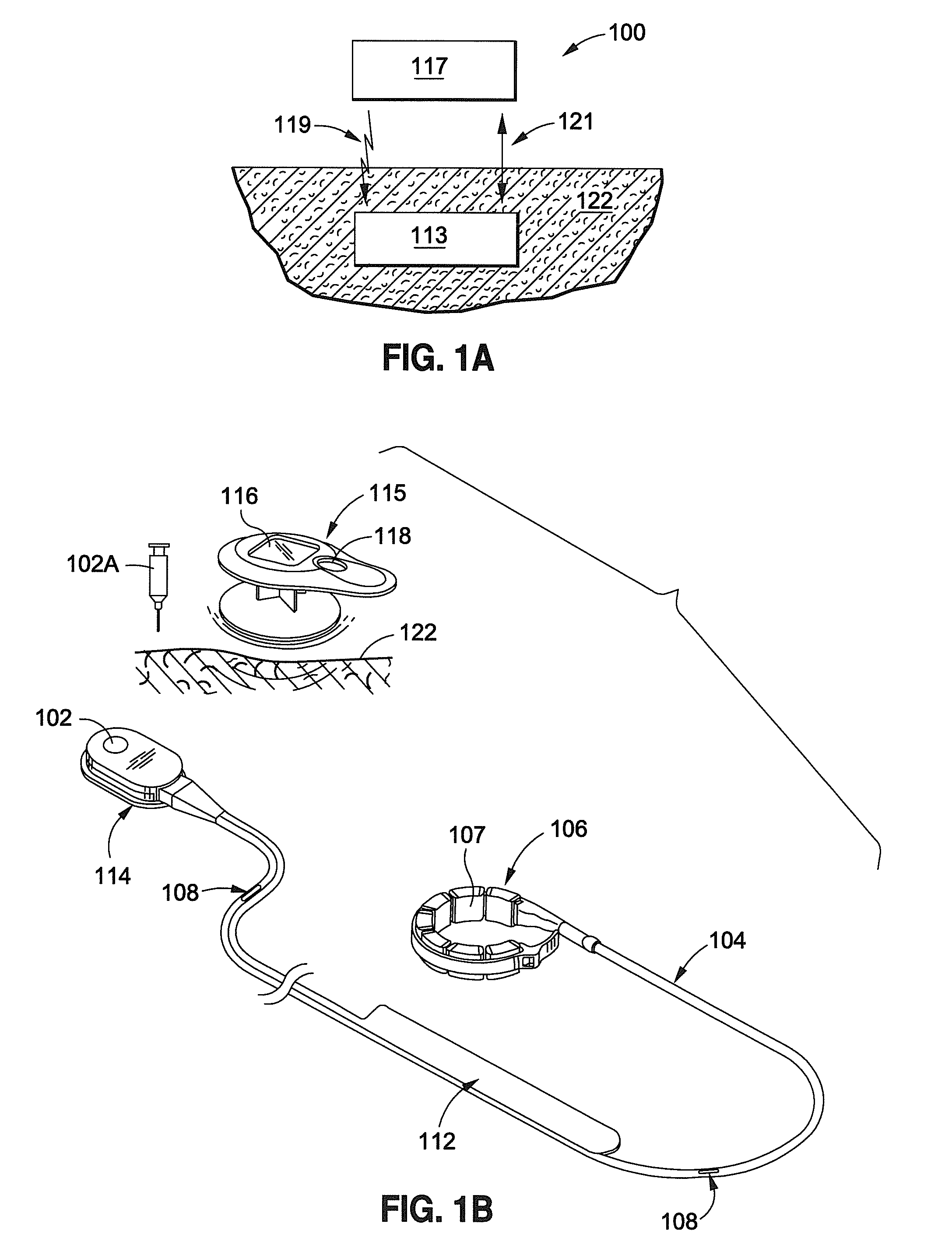 Inductively powered remotely adjustable gastric banding system
