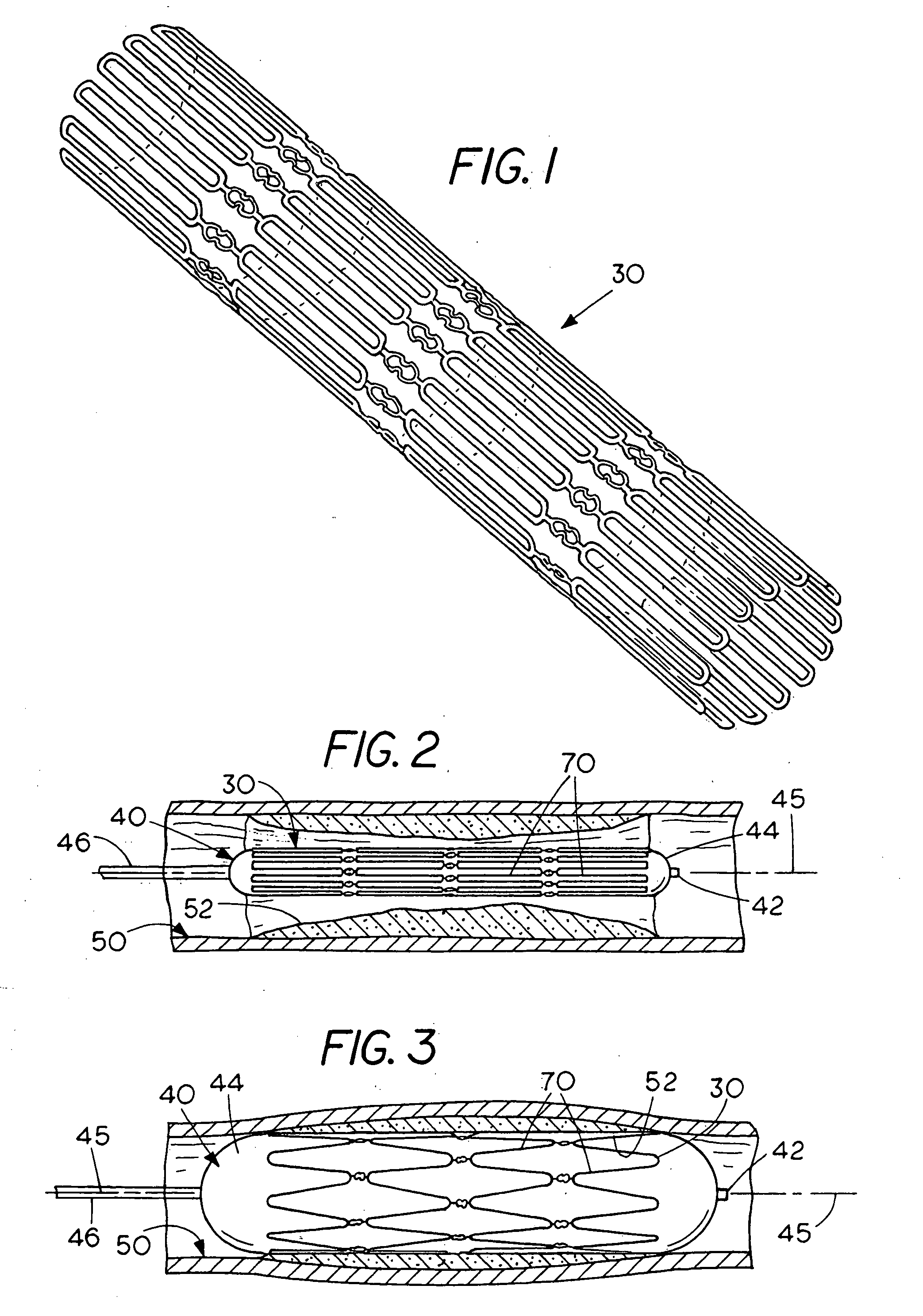 Flexible cells for interconnecting stent components