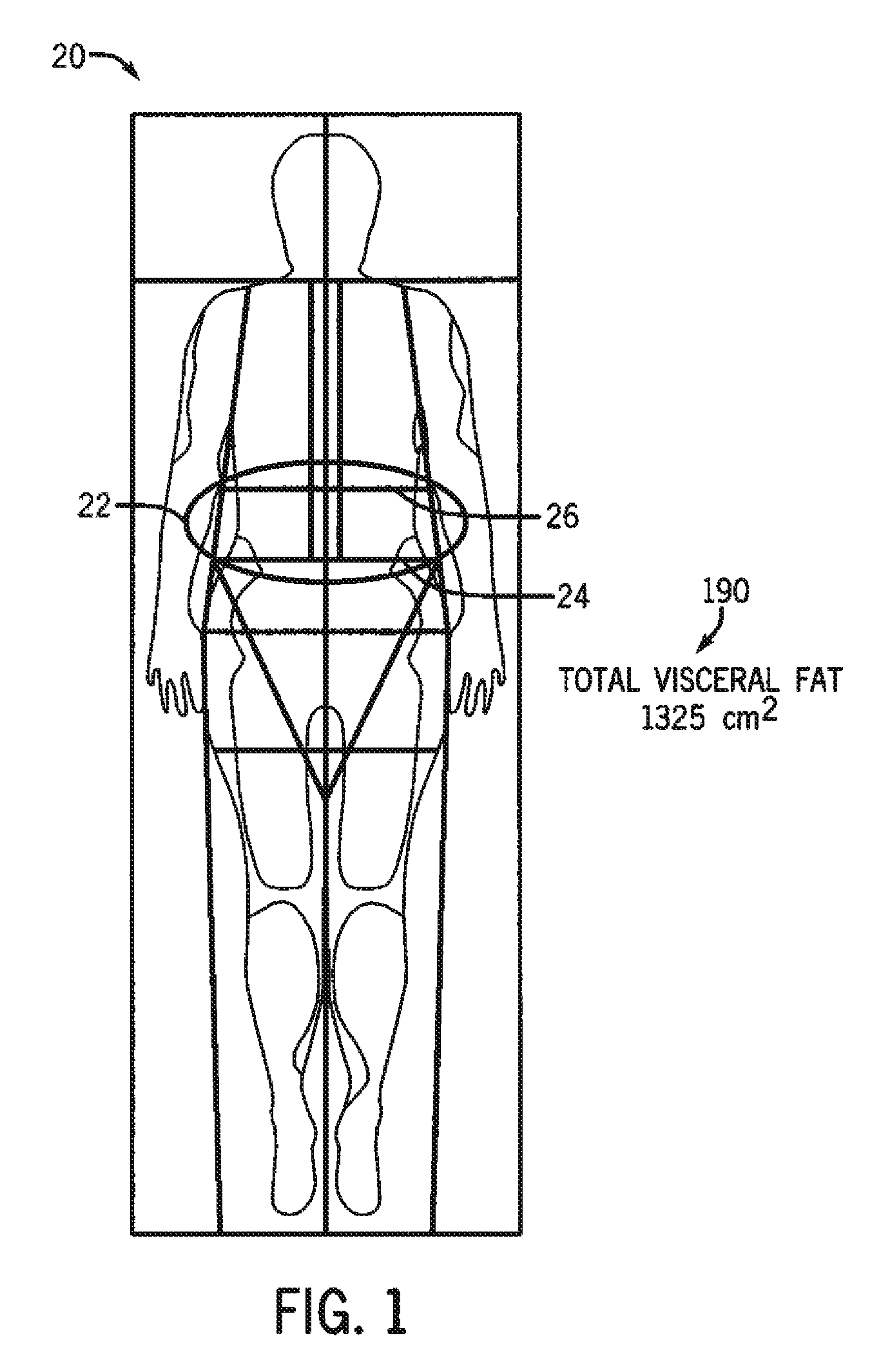 Methods and apparatus for measuring visceral fat mass