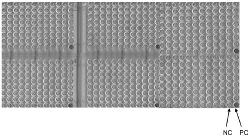 Anti-mHIN2 protein antibody, application thereof, and kit containing antibody