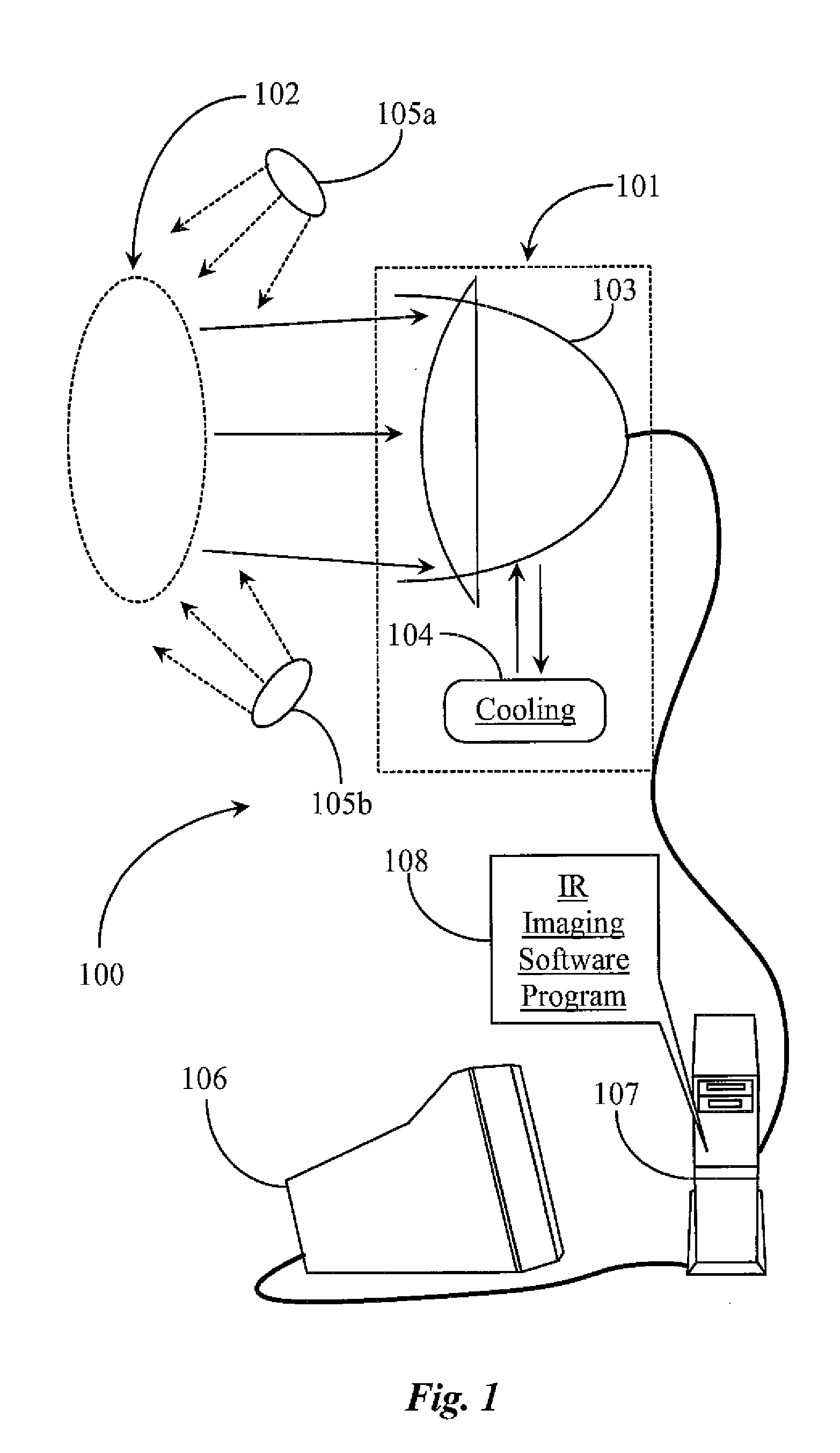 Method for Detecting and/or Monitoring a Wound Using Infrared Thermal Imaging